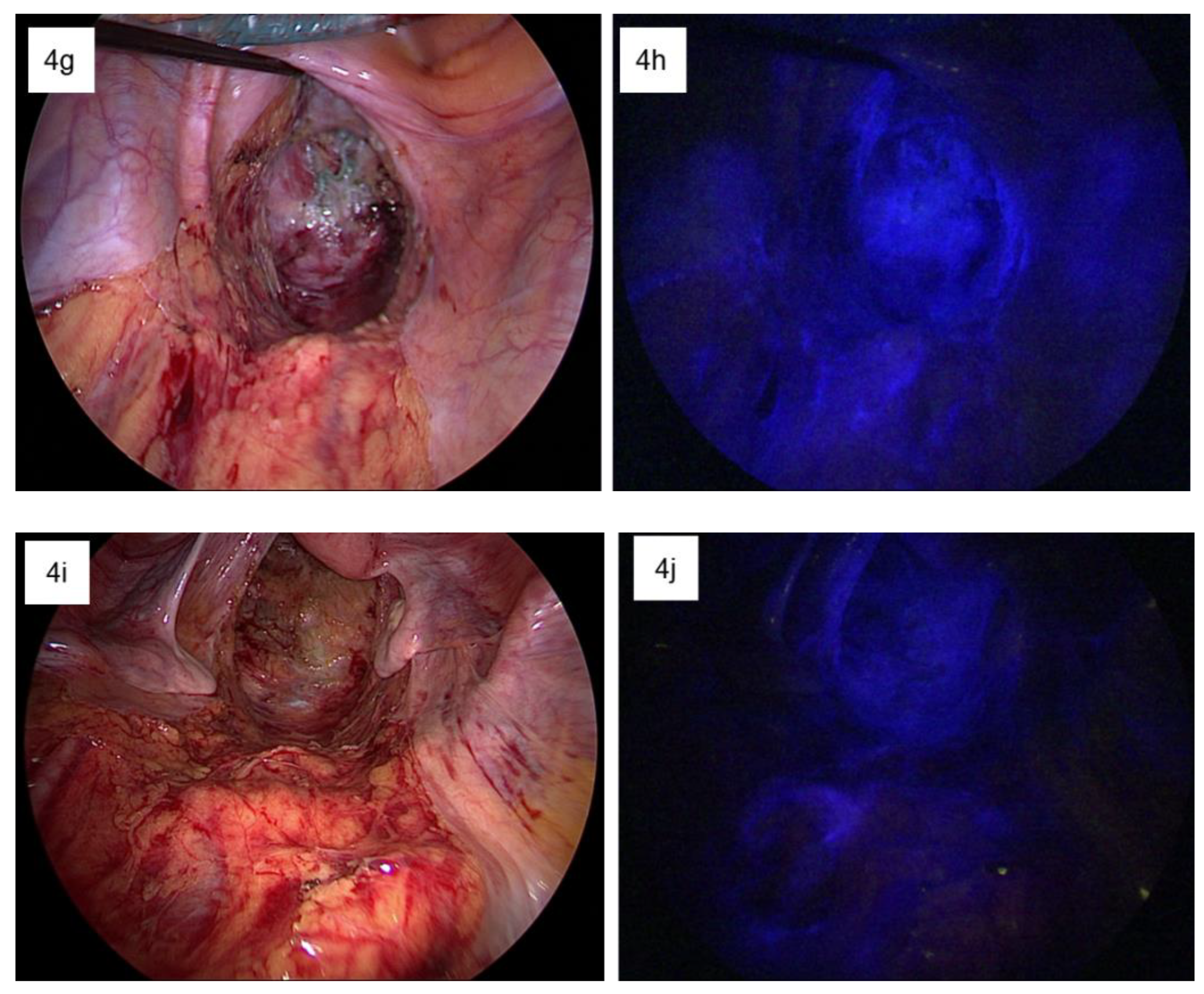 Biomedicines 11 00274 g004b Biomedicines 11 00274 g004b