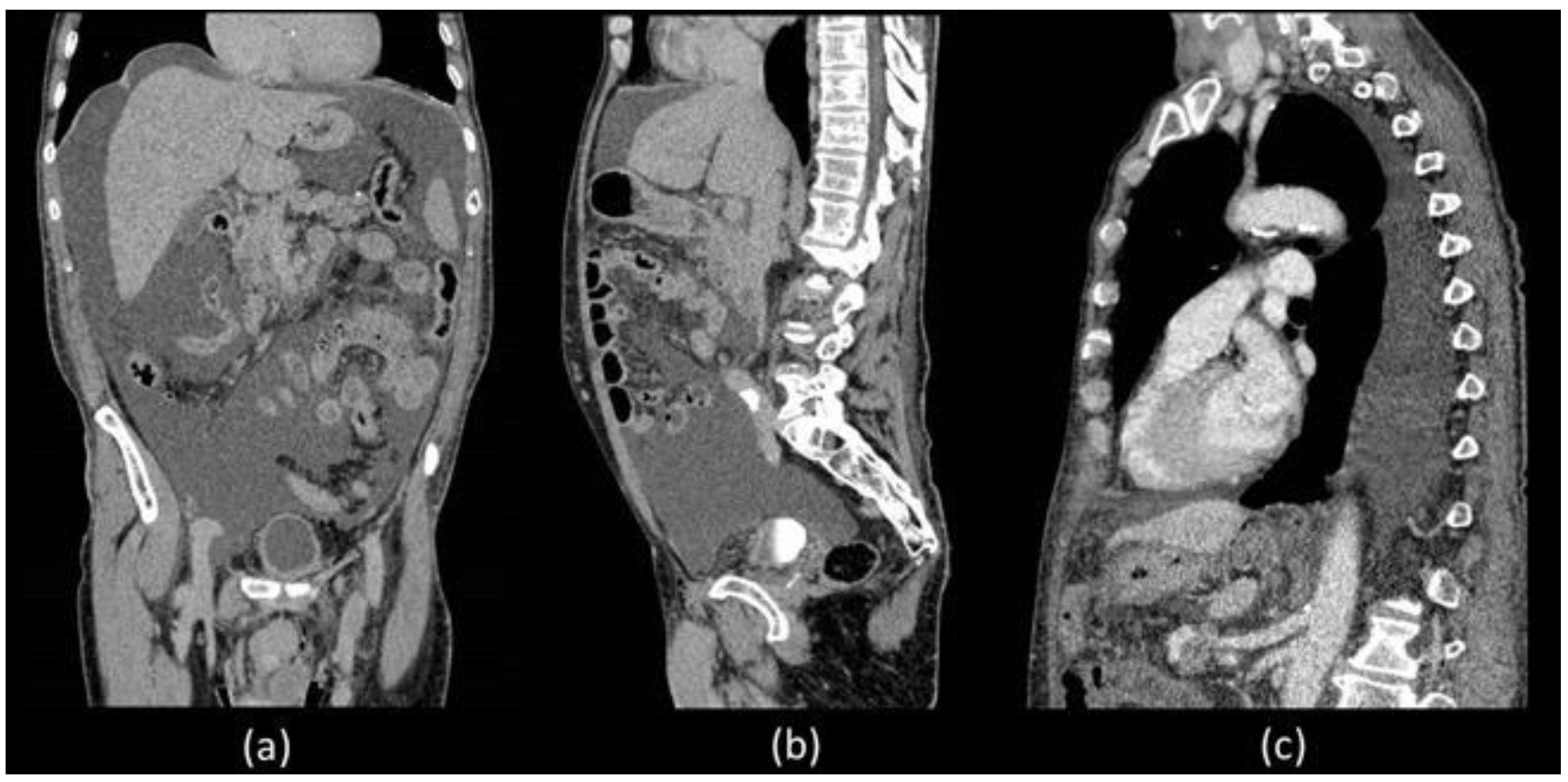 Biomedicines 11 00282 g001