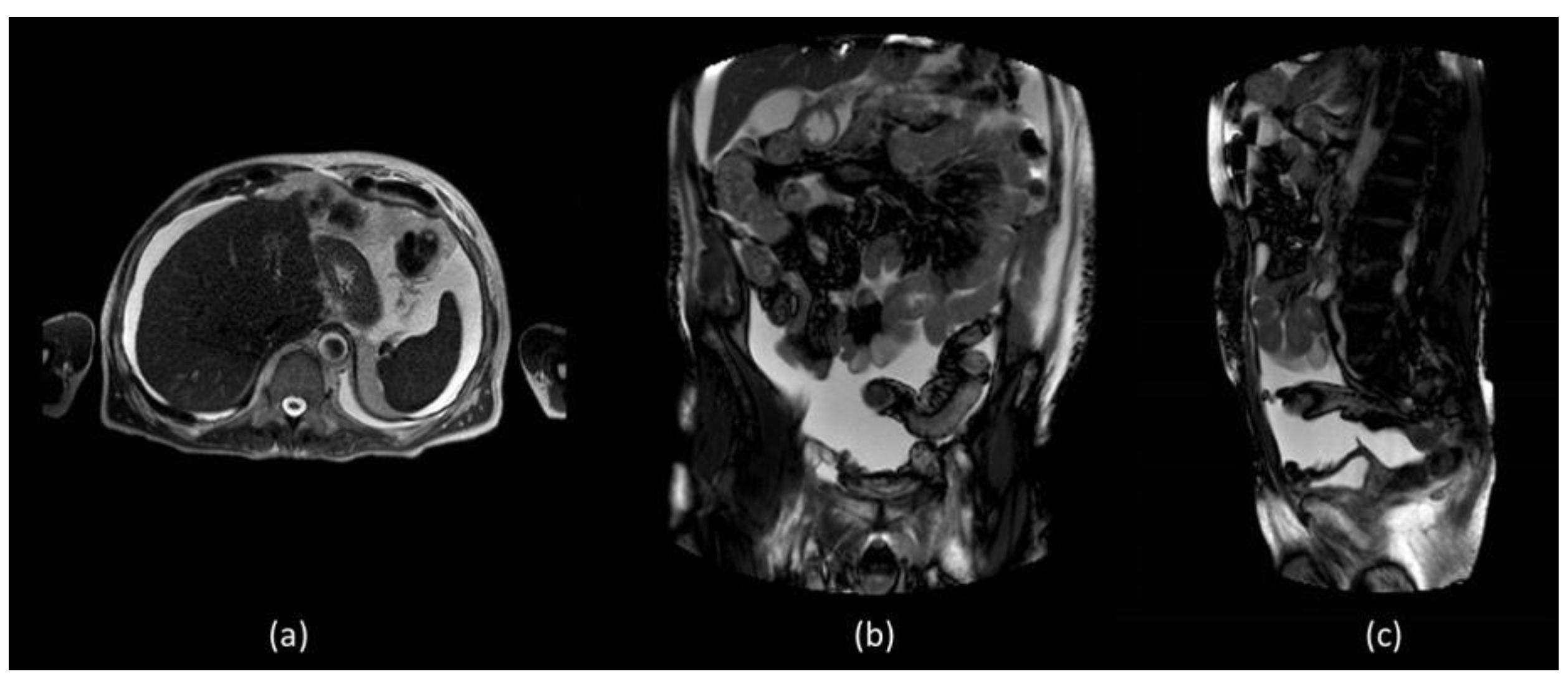 Biomedicines 11 00282 g002
