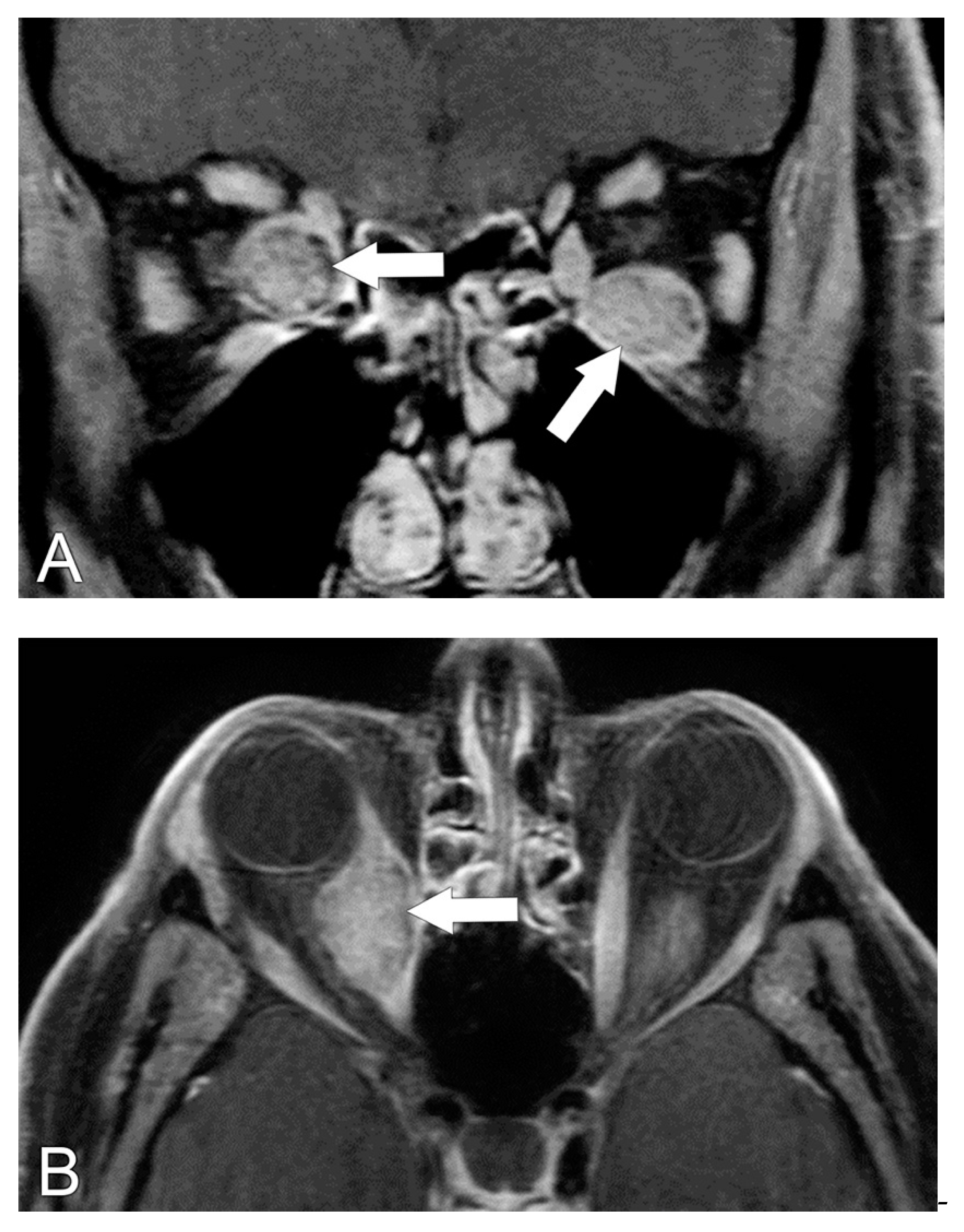 Biomedicines 11 00312 g008