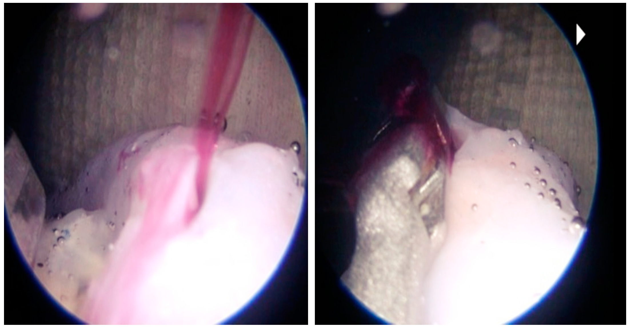 Biomedicines 11 00330 g006