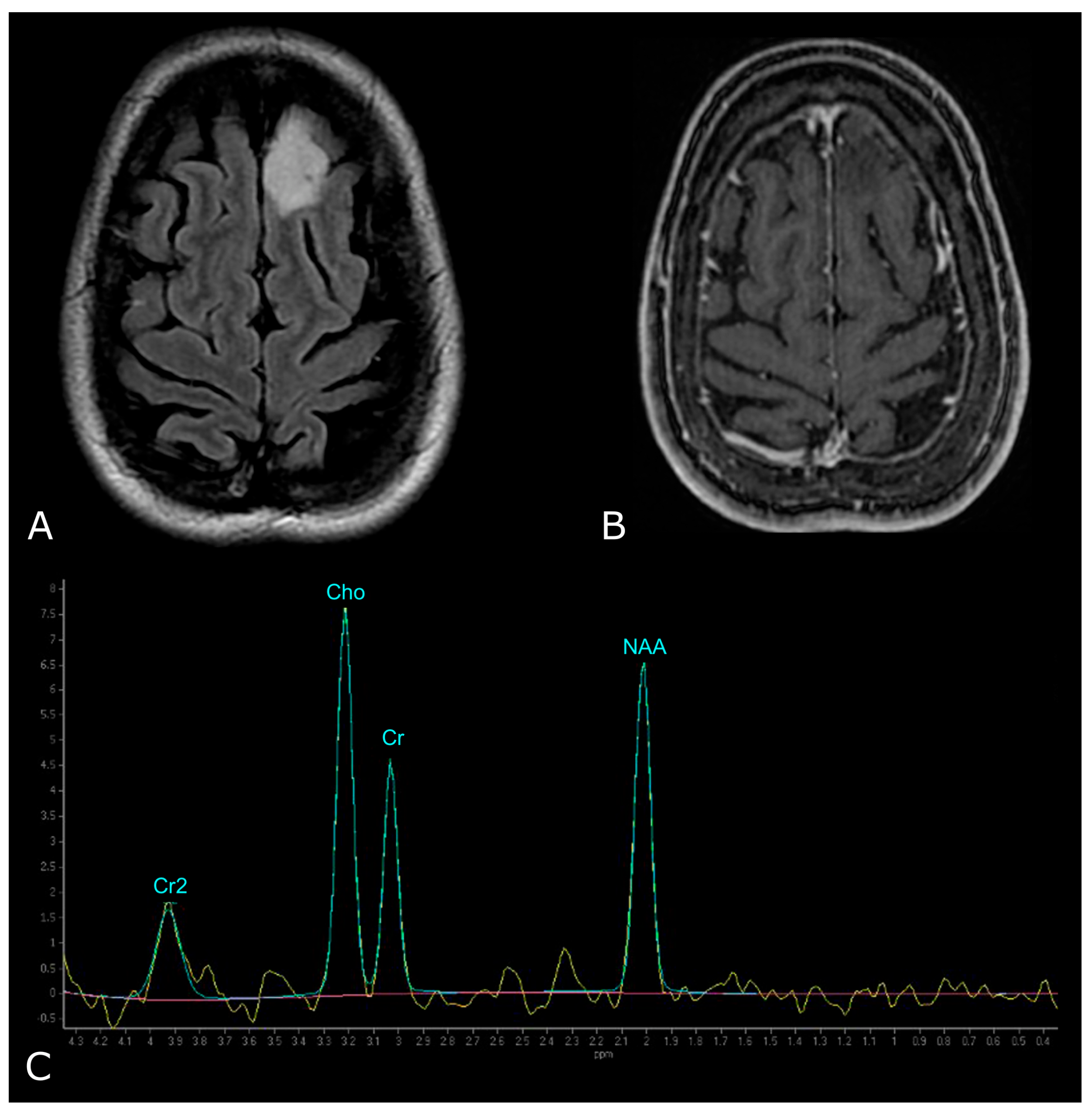 Biomedicines 11 00364 g009 Biomedicines 11 00364 g009