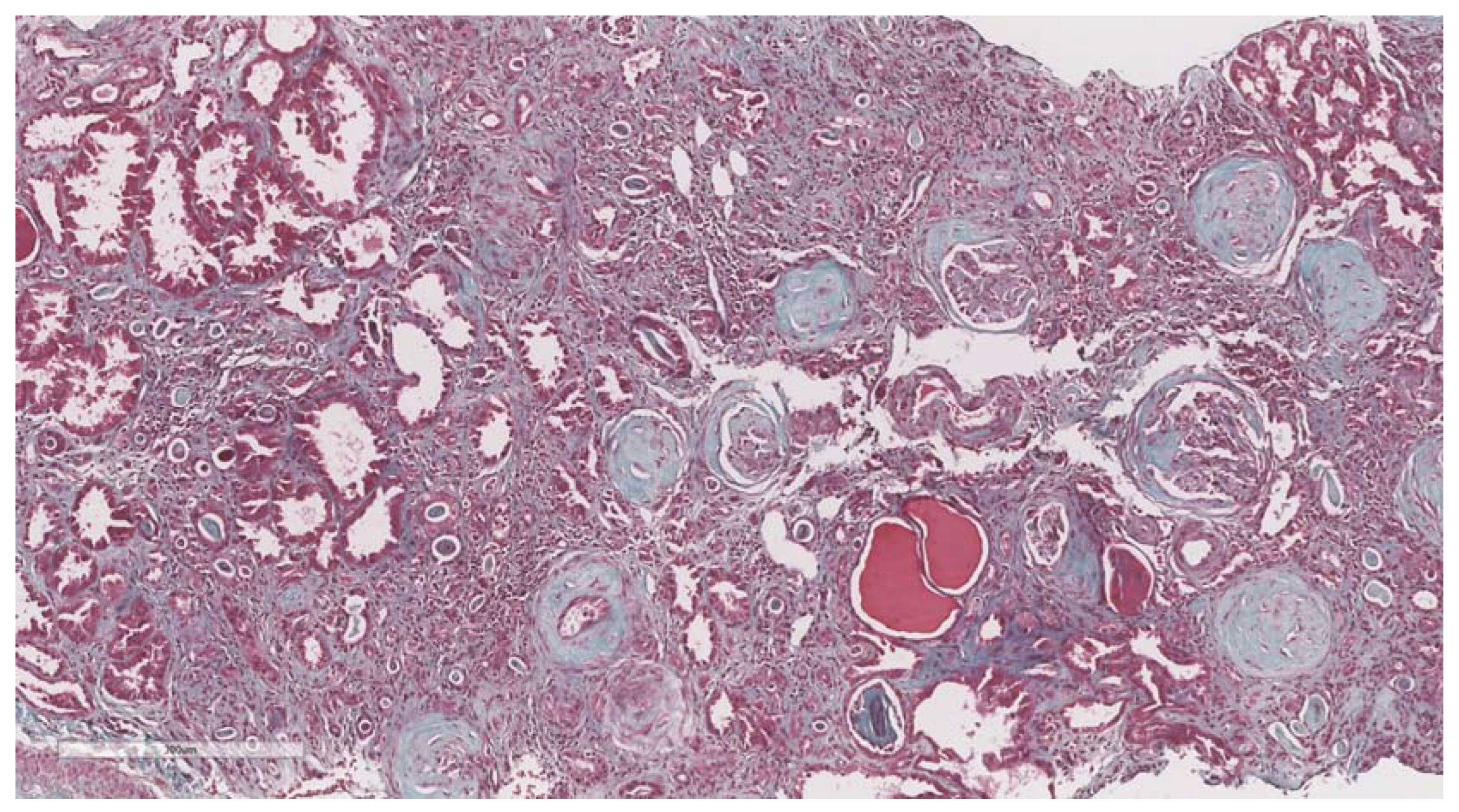 Biomedicines 11 00365 g005 Biomedicines 11 00365 g005