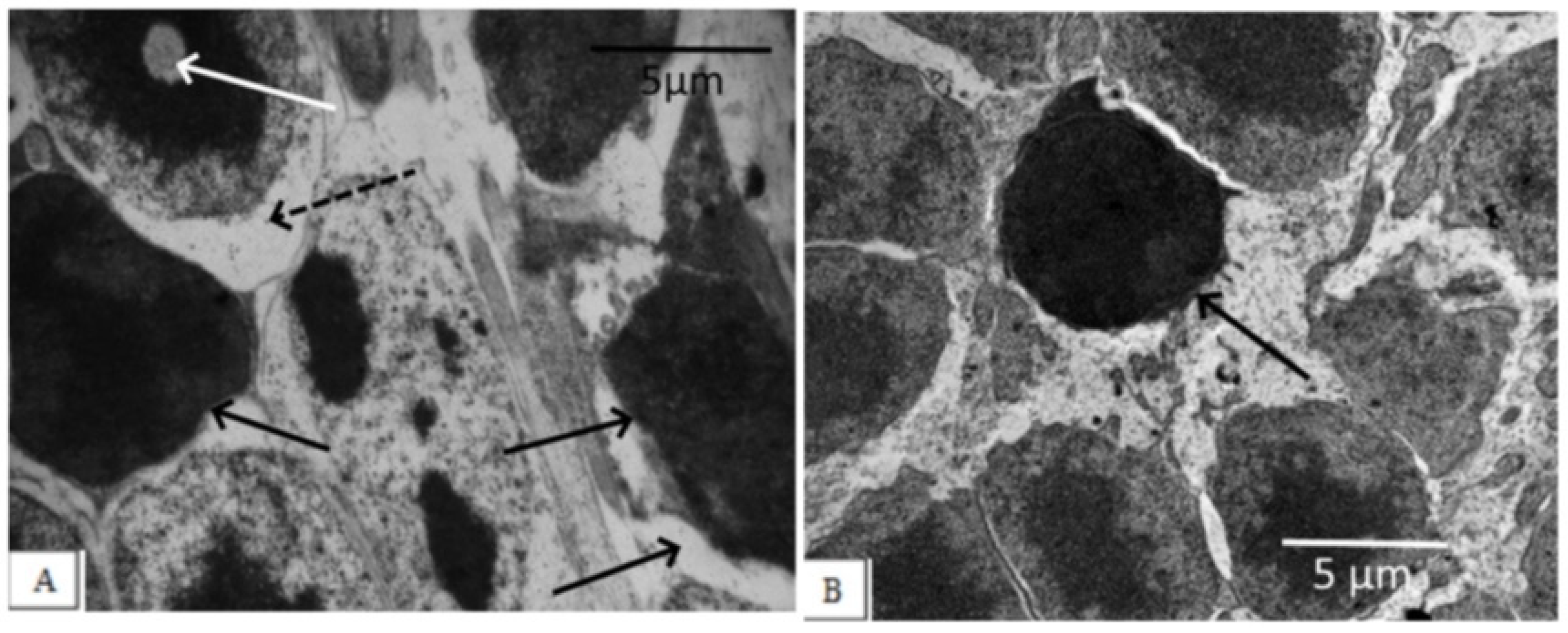 Biomedicines 11 00395 g002 Biomedicines 11 00395 g002