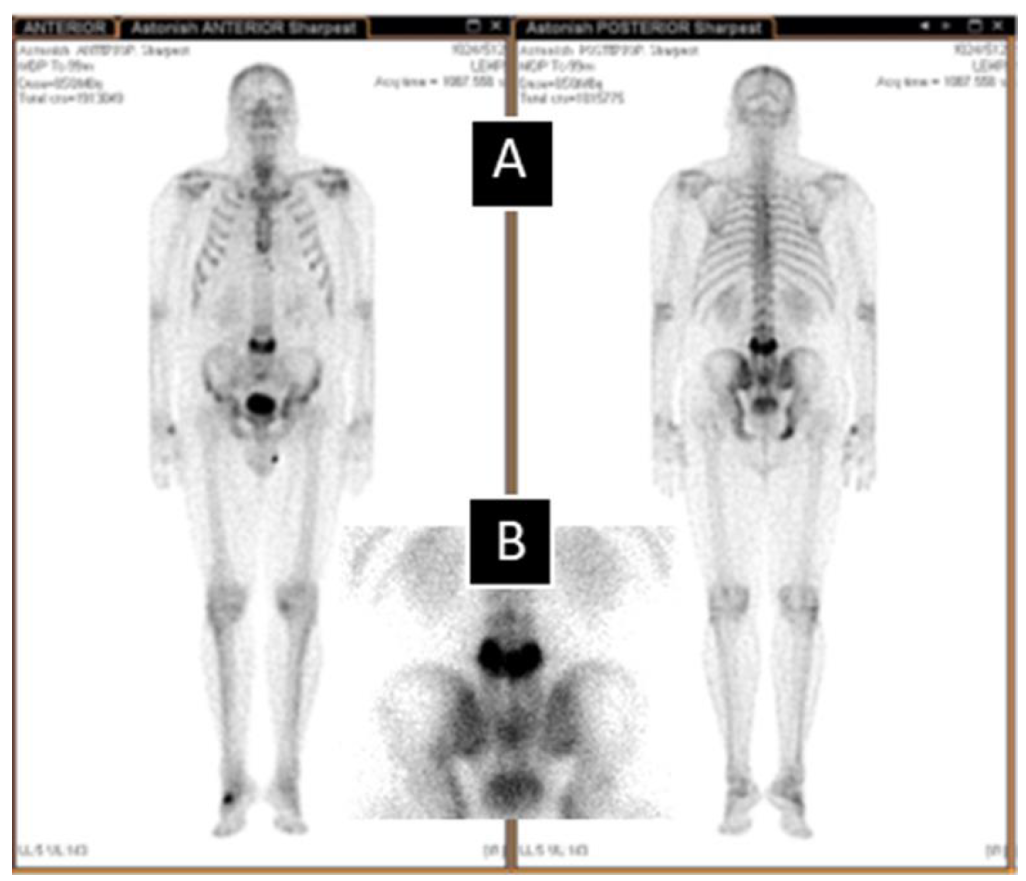 Biomedicines 11 00401 g002 Biomedicines 11 00401 g002