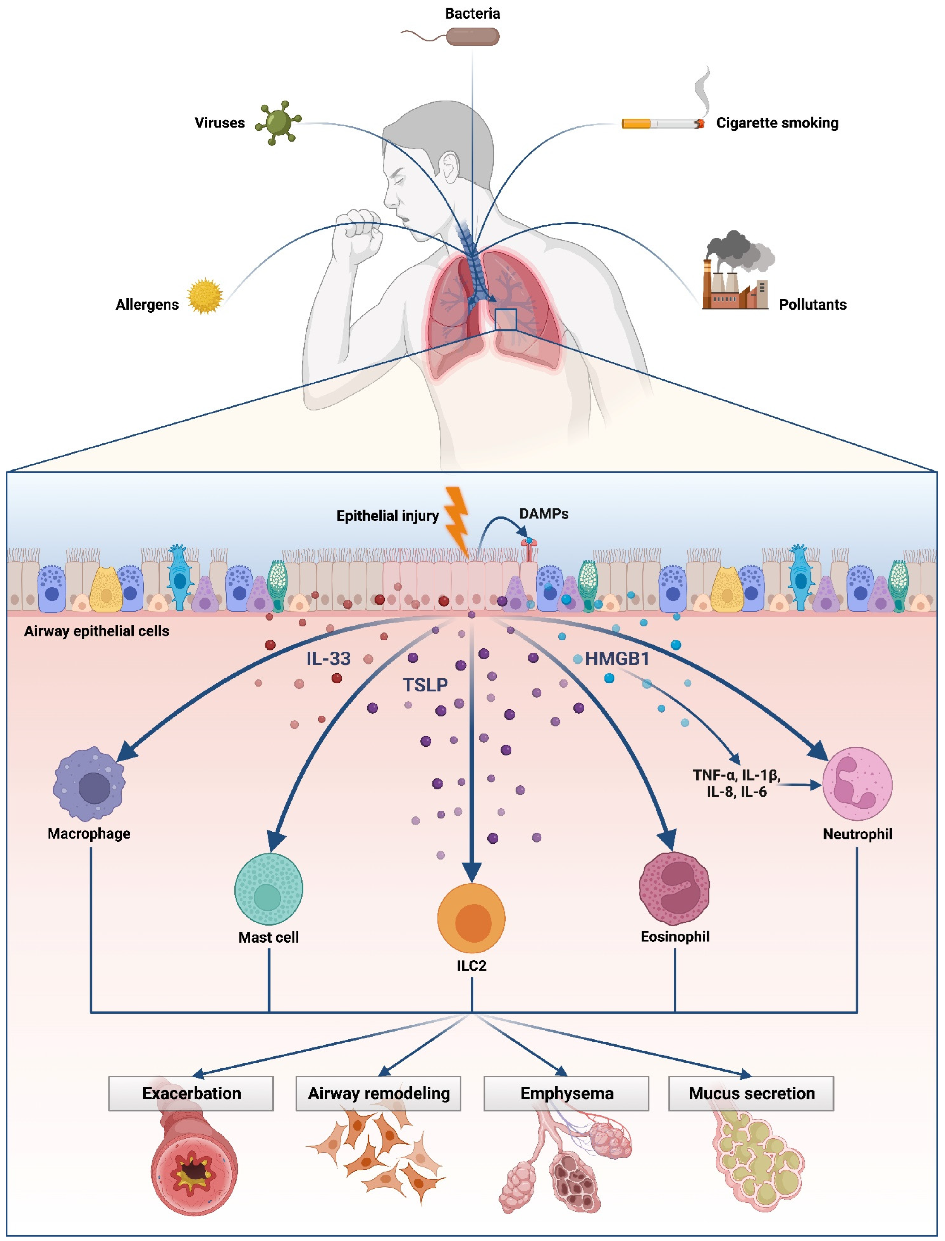 Staphylococcus aureus Orchestrates Type 2 Airway Diseases: Trends in Molecular Medicine