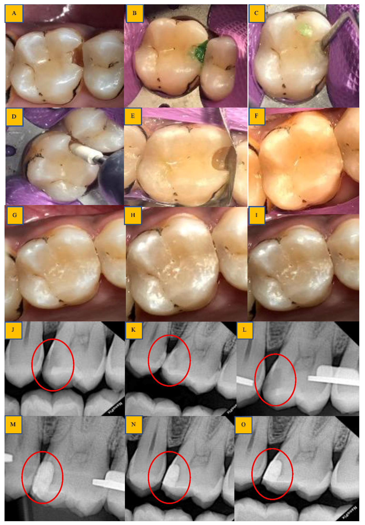 Biomedicines 11 00500 g005 Biomedicines 11 00500 g005