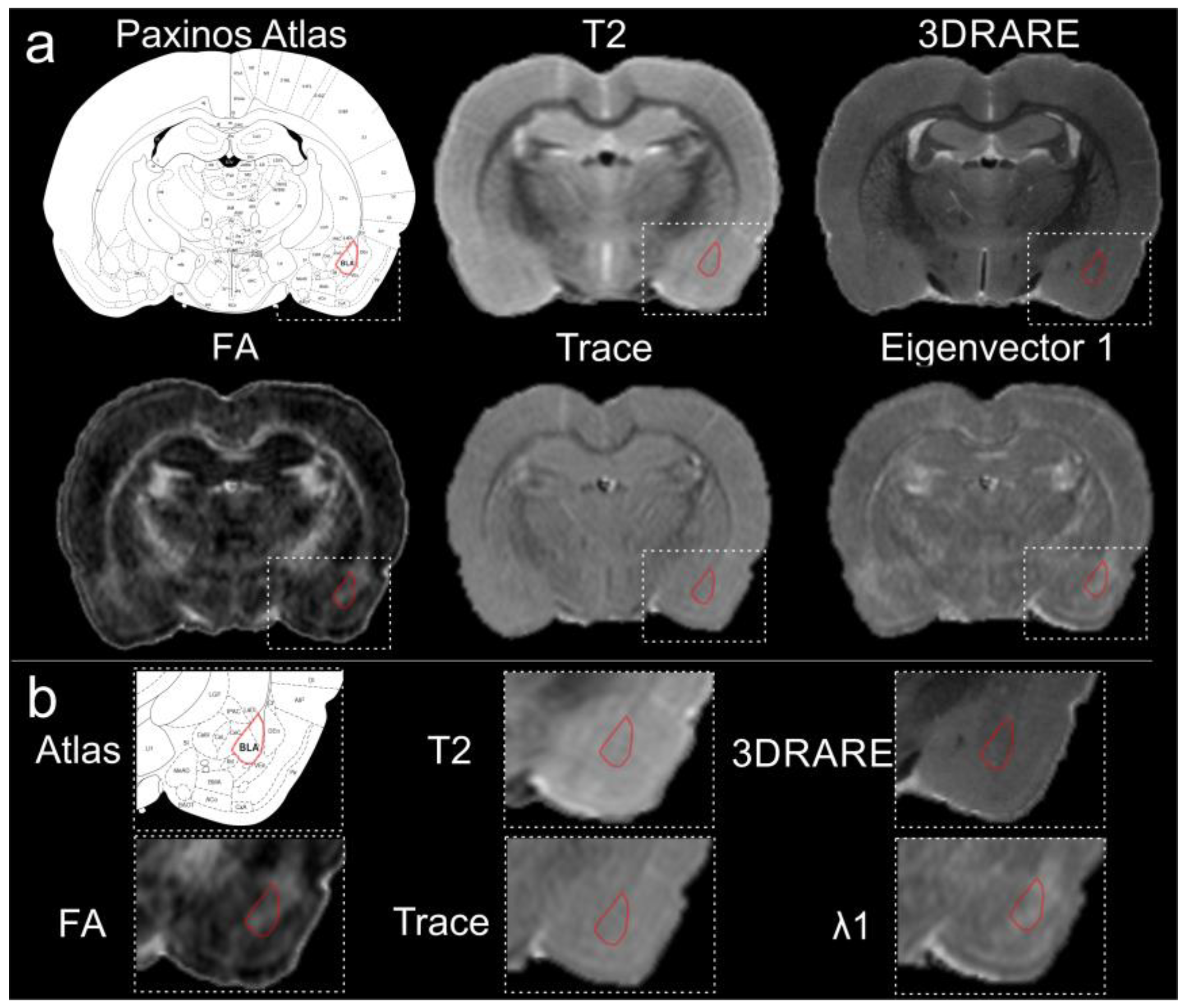 Biomedicines | Free Full-Text | Seeking the Amygdala: Novel Use of ...