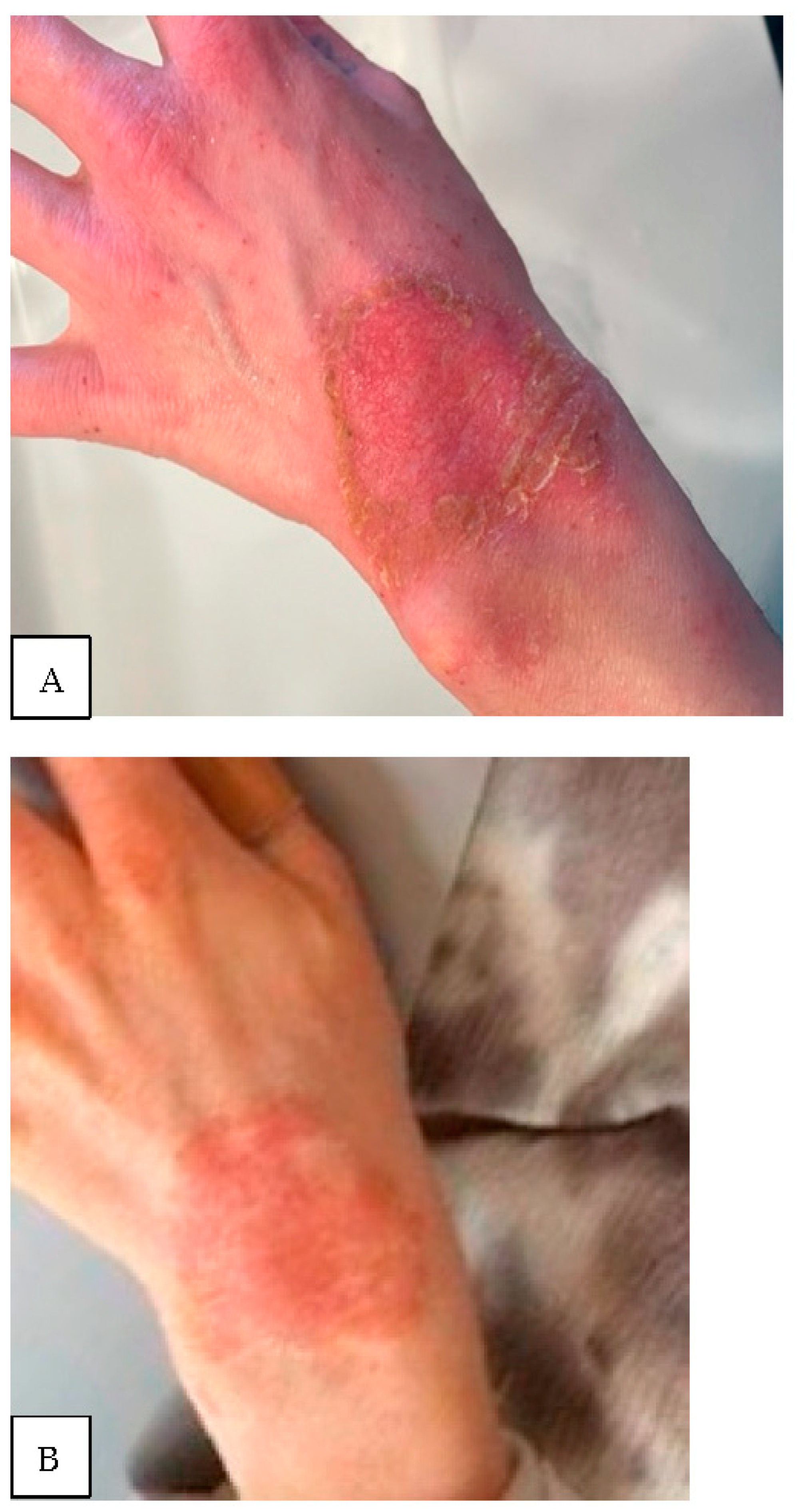 Biomedicines 11 00537 g002 550