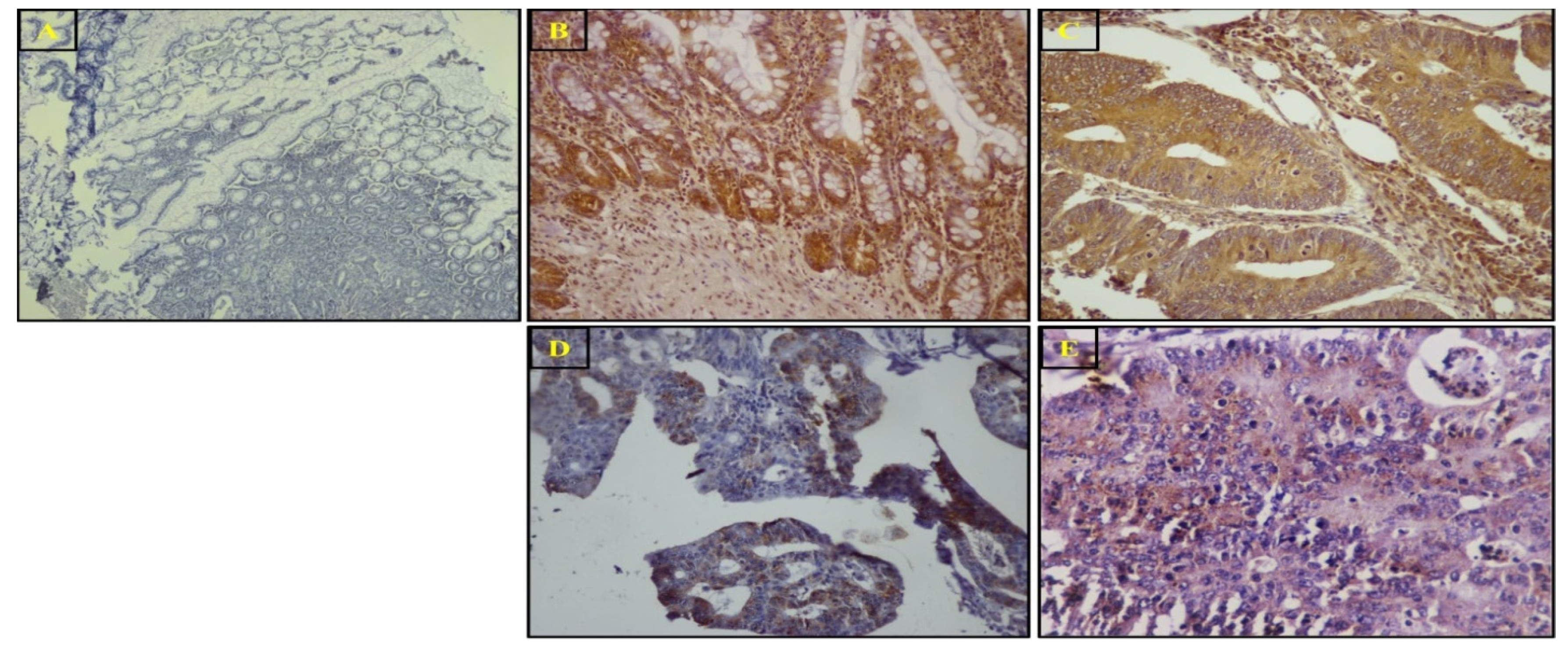 Biomedicines 11 00540 g004