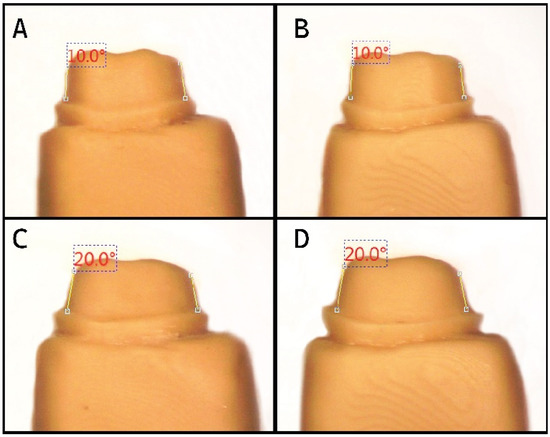 The Effect of a Digital Manufacturing Technique, Preparation Taper, and ...