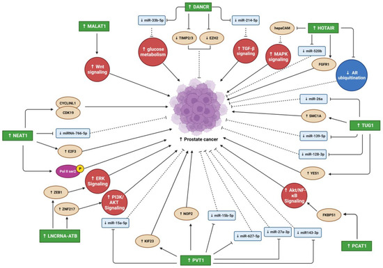 Oncogenic Long Noncoding RNAs in Prostate Cancer, Osteosarcoma
