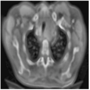 Biomedicines 11 00679 i006