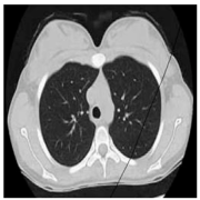 Biomedicines 11 00679 i007