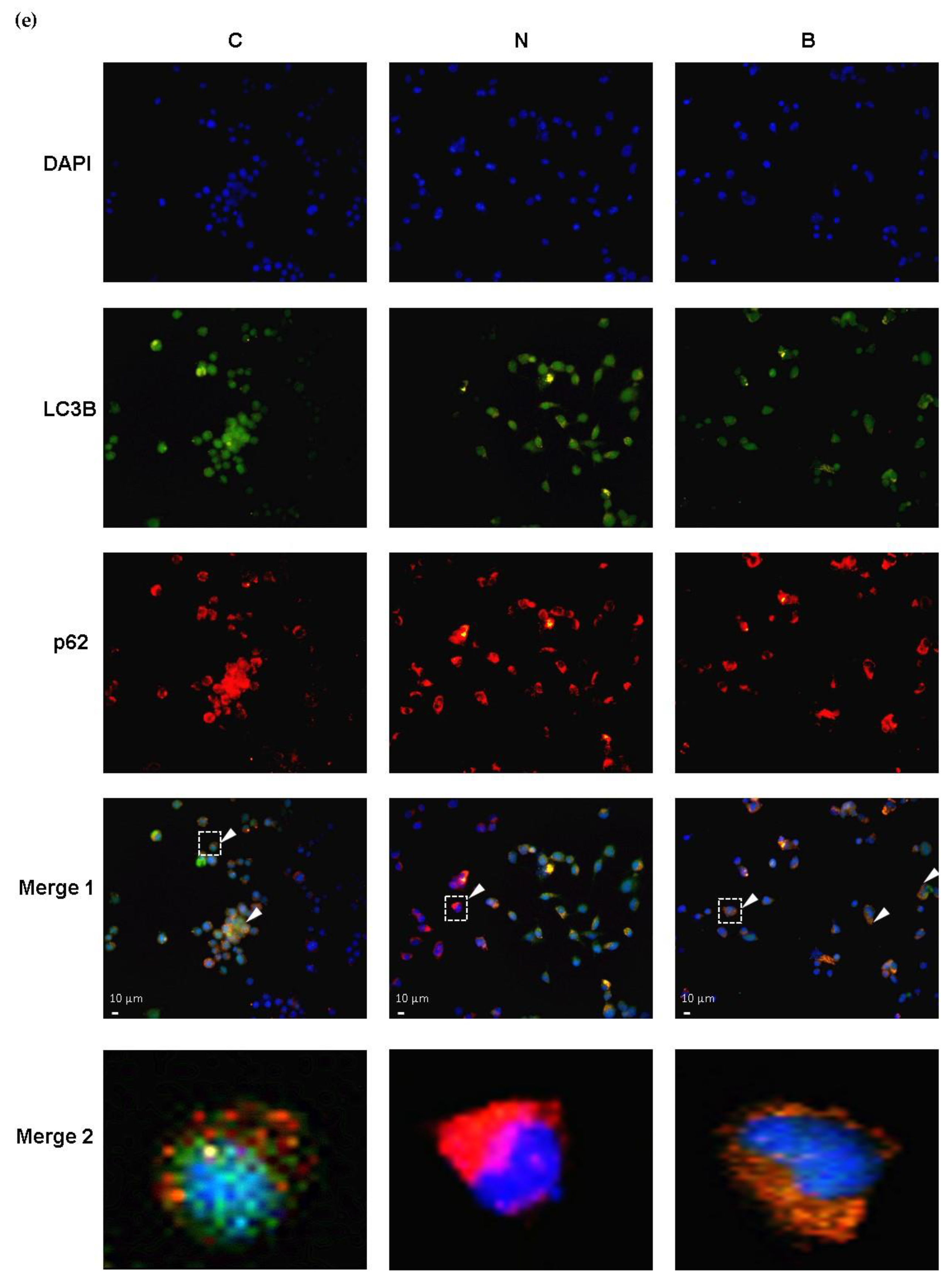 Biomedicines 11 00698 g004b Biomedicines 11 00698 g004b