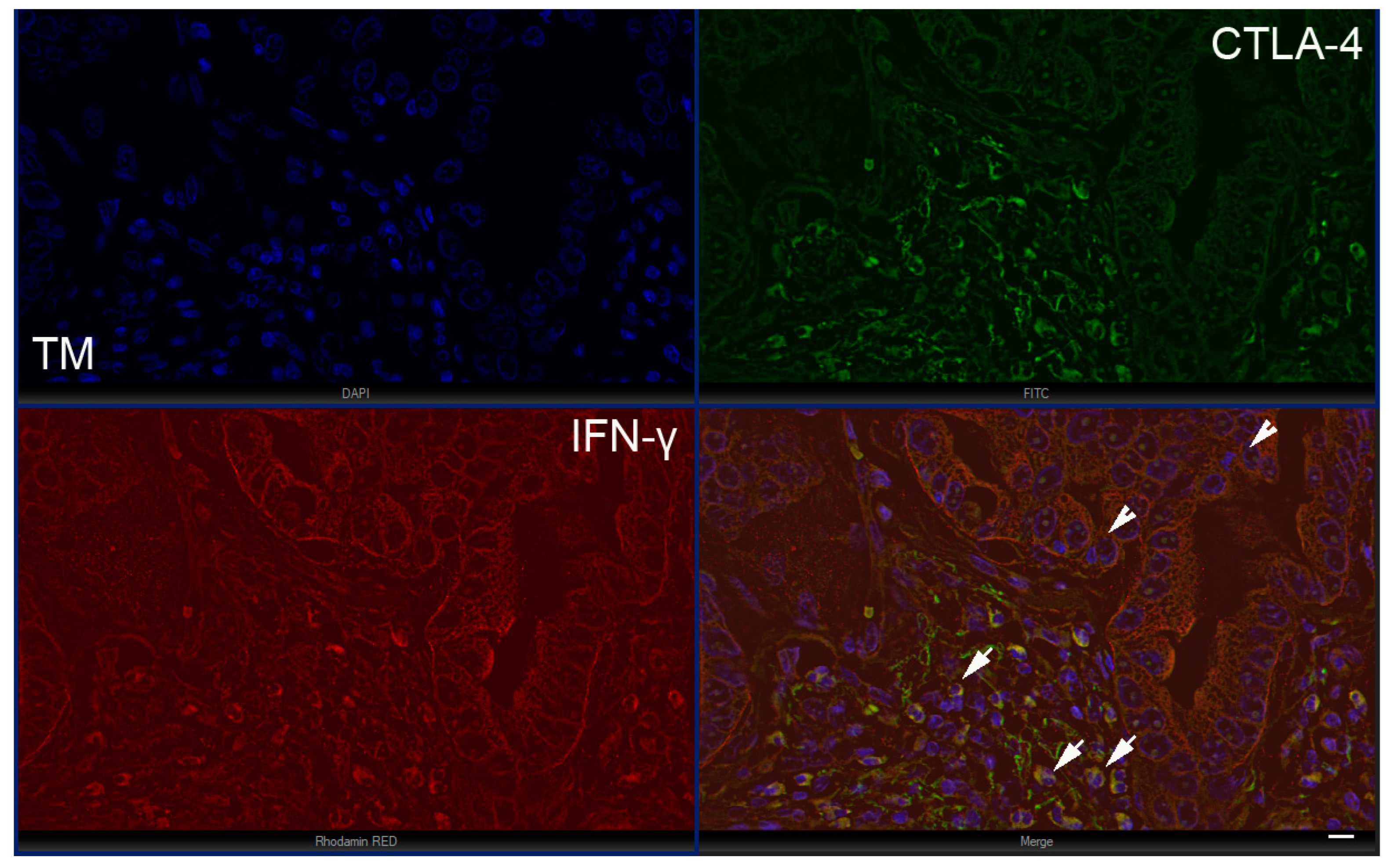 Biomedicines 11 00709 g005