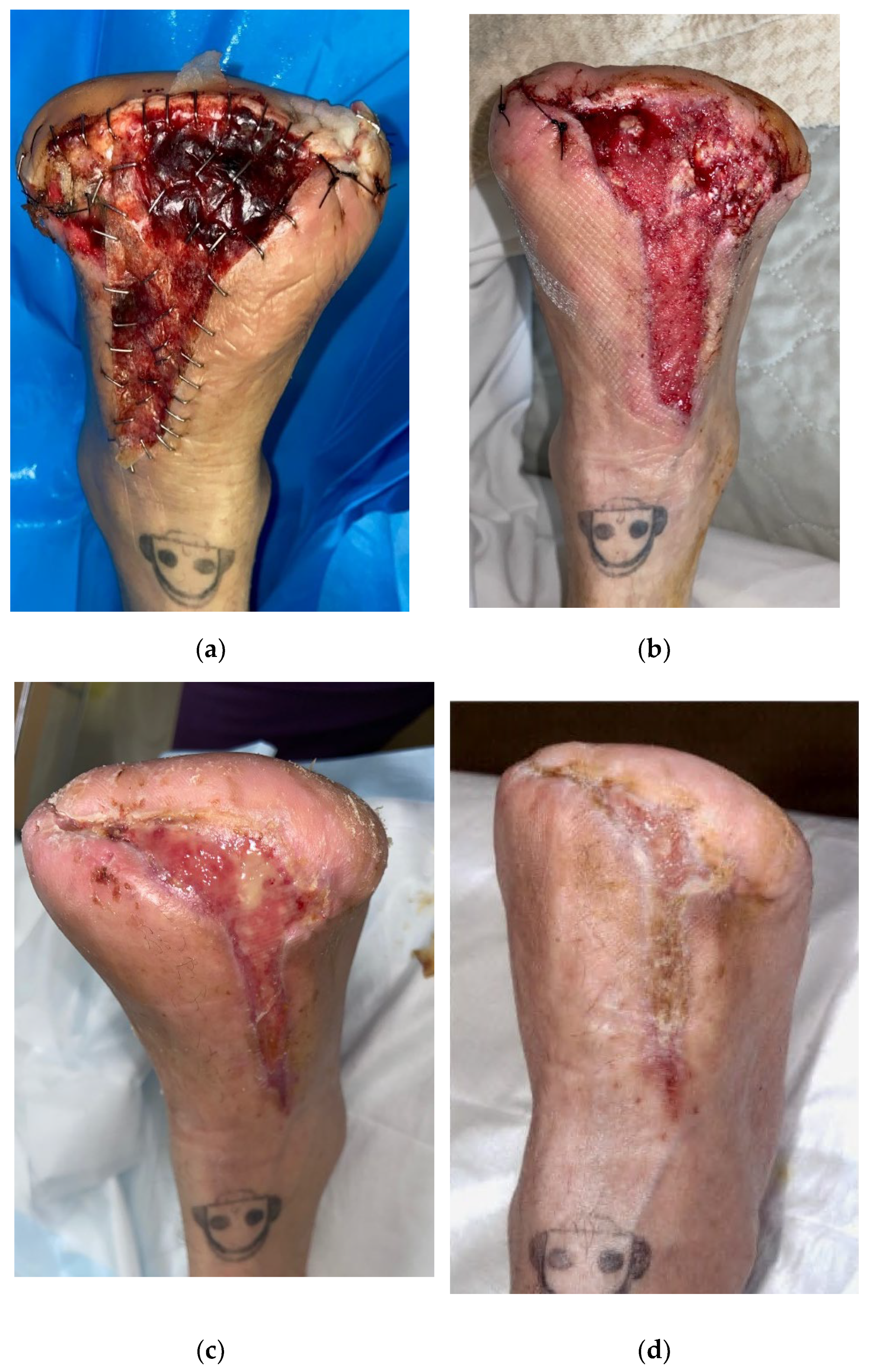 Biomedicines 11 00721 g002