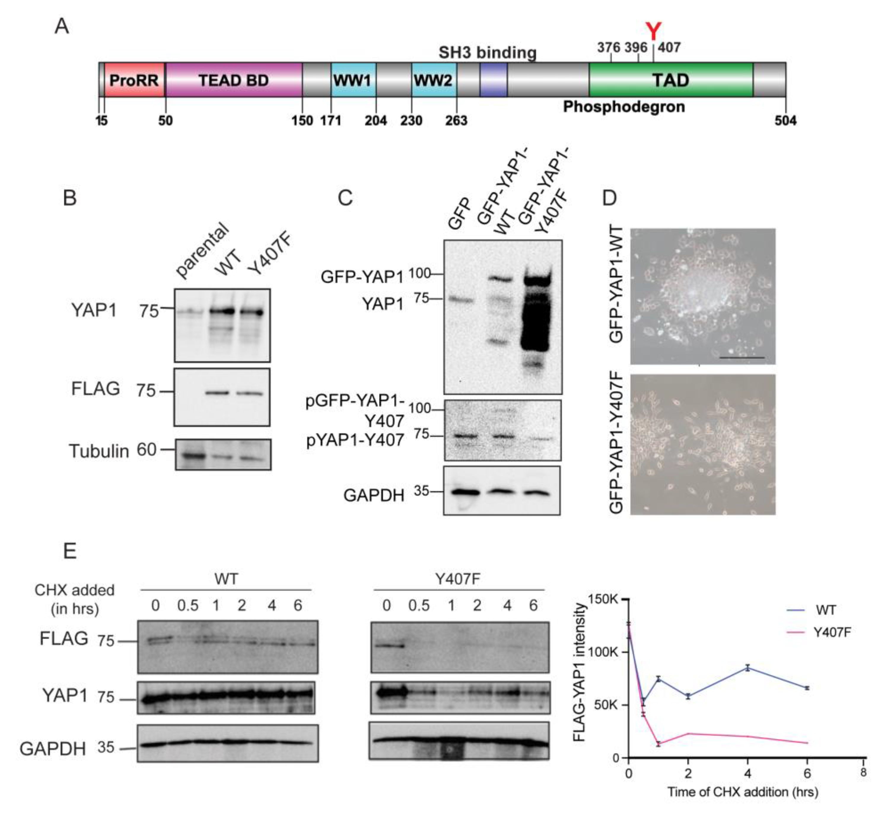 NEK1-Mediated Phosphorylation of YAP1 Is Key to Prostate Cancer Progression