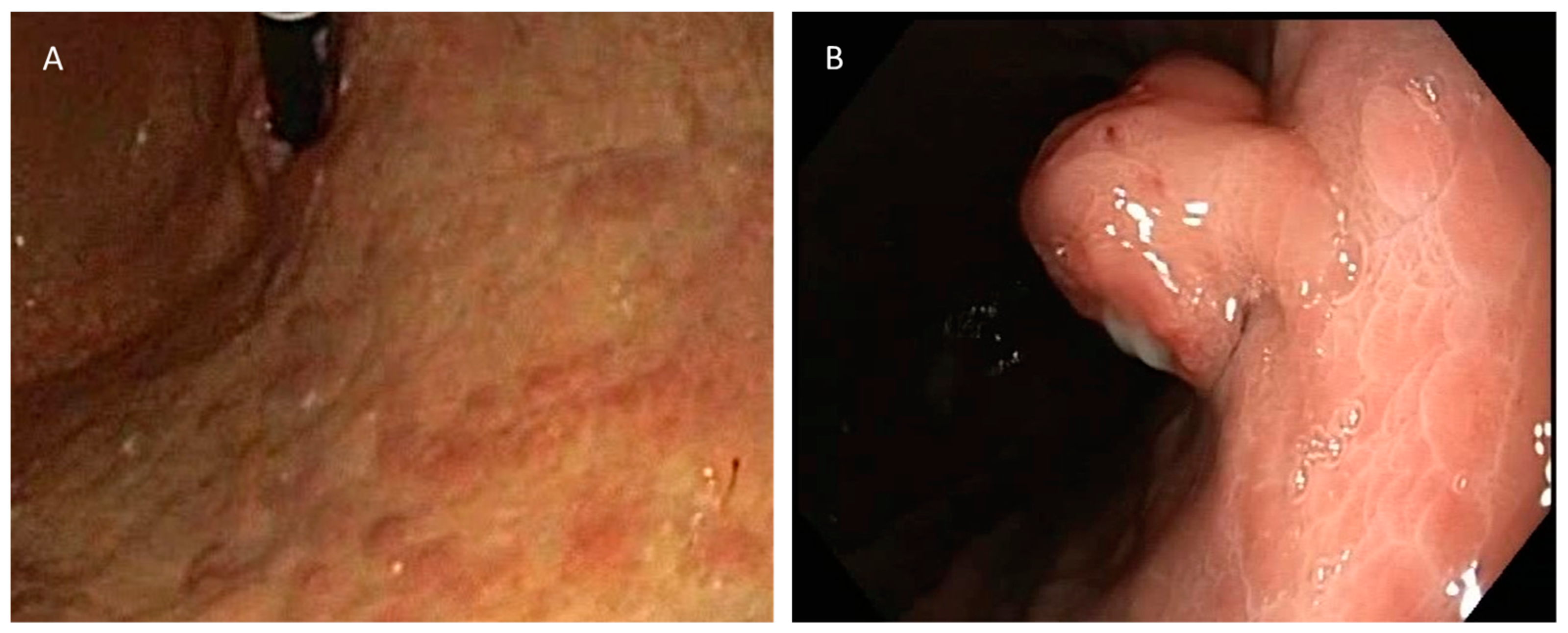 Biomedicines 11 00828 g001