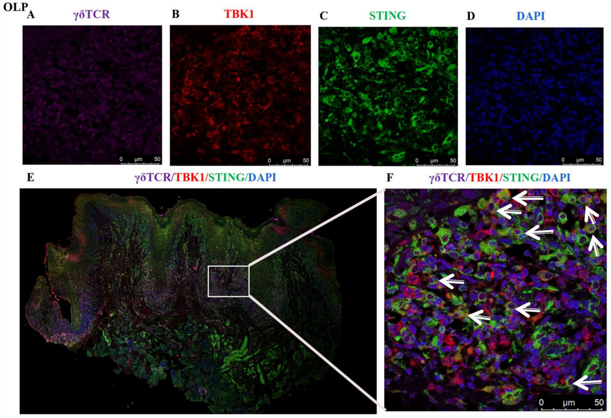 Biomedicines 11 00955 g005