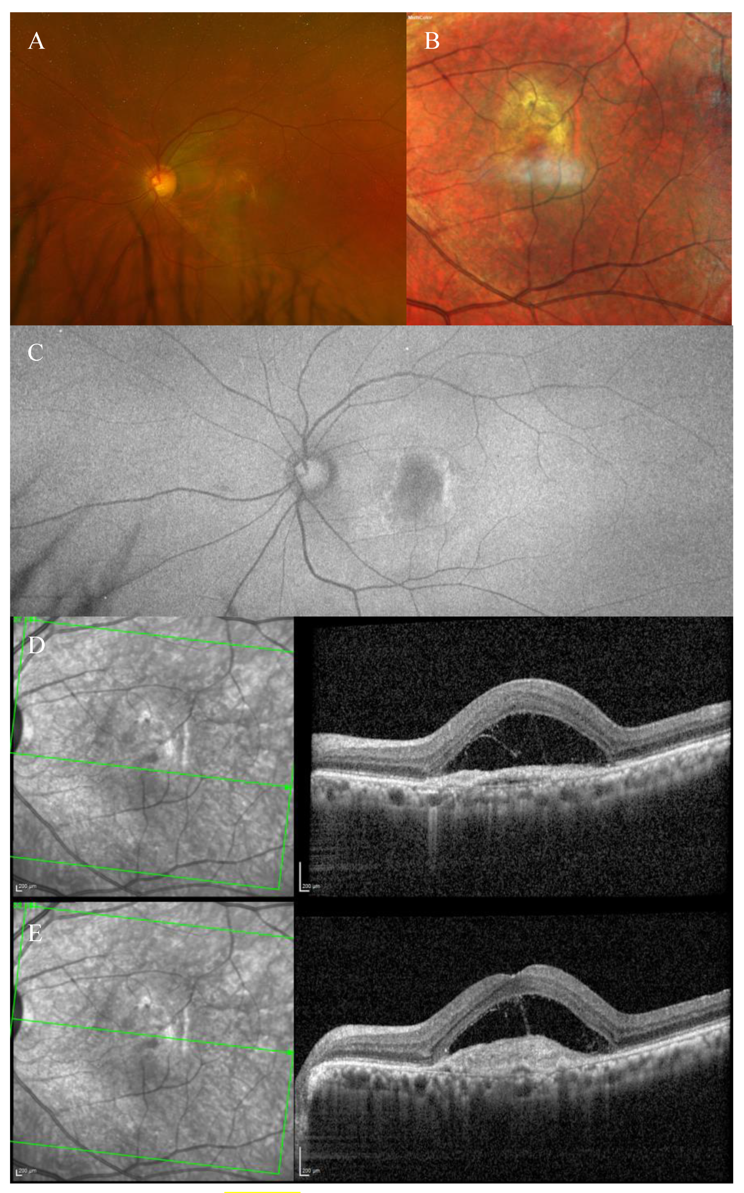 Biomedicines 11 00988 g004