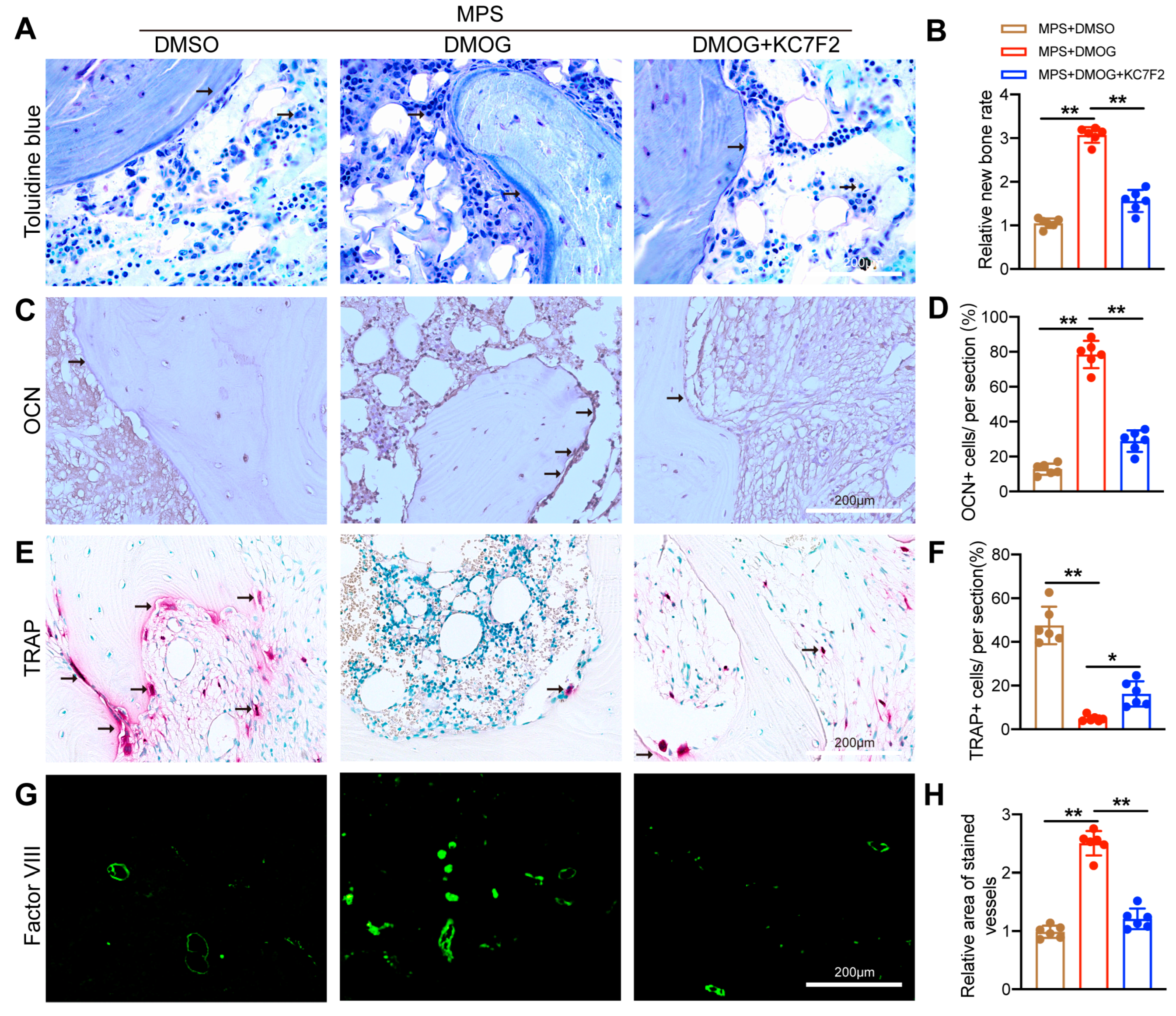 Biomedicines 11 00992 g005 Biomedicines 11 00992 g005
