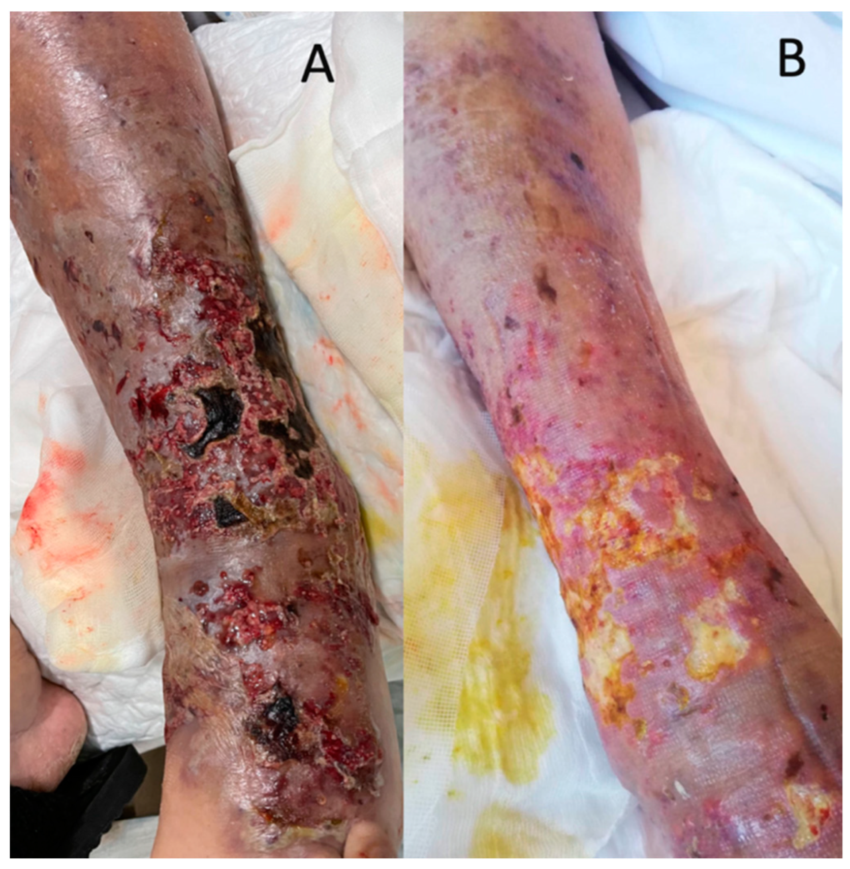 Biomedicines 11 01007 g001 Biomedicines 11 01007 g001