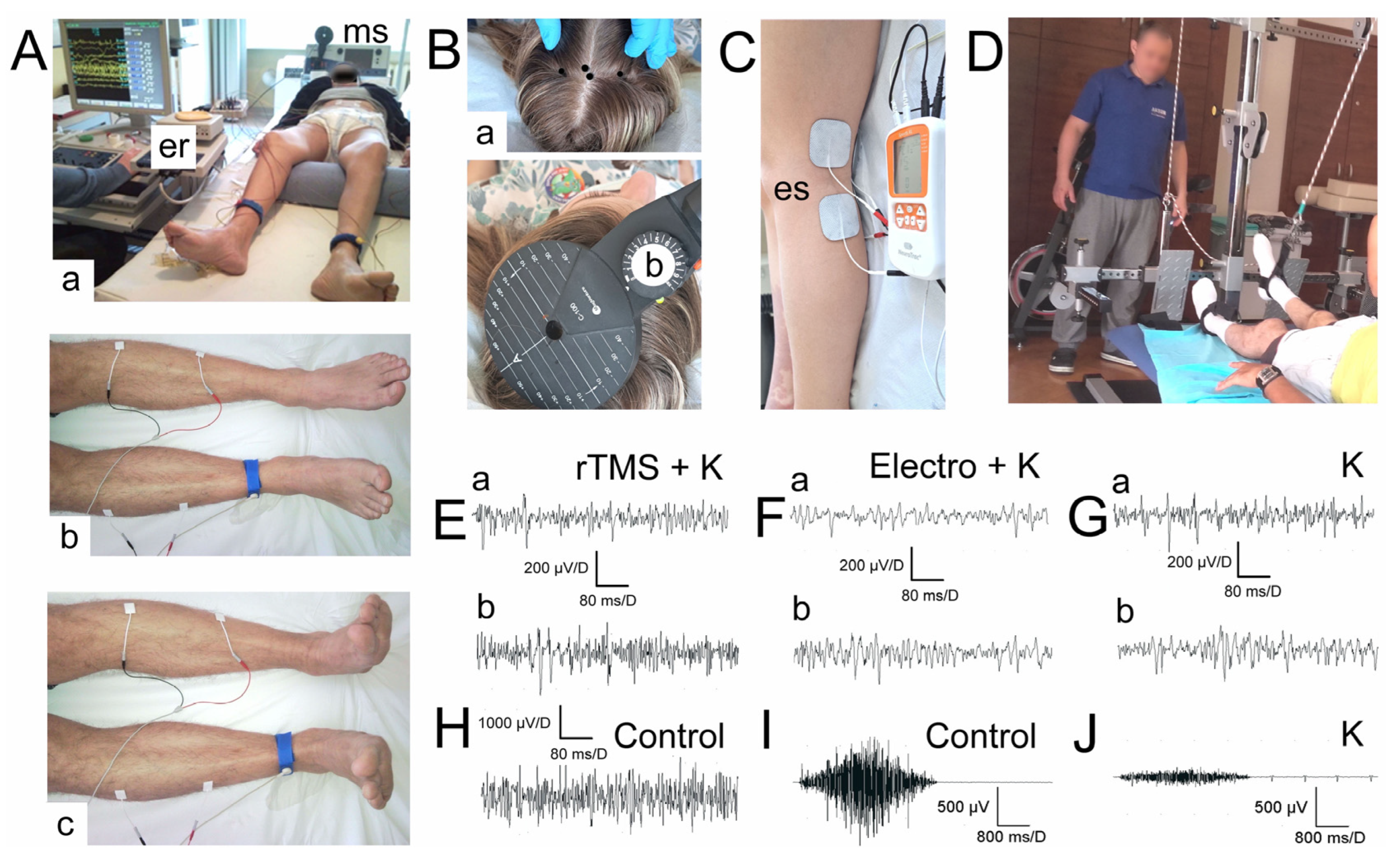 Nerve And Muscle Stimulator Electrotherapy for Hospital