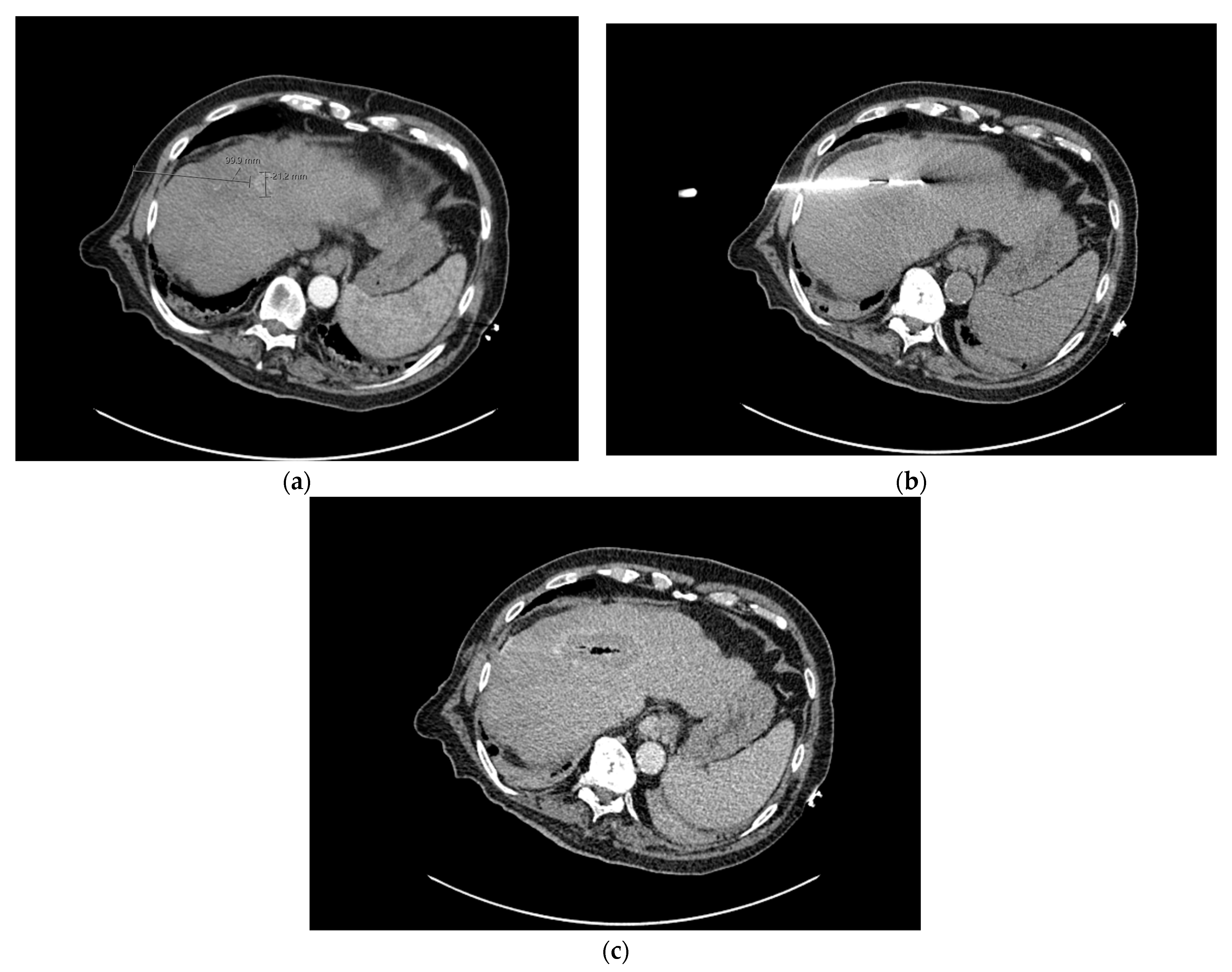 Biomedicines 11 01062 g002