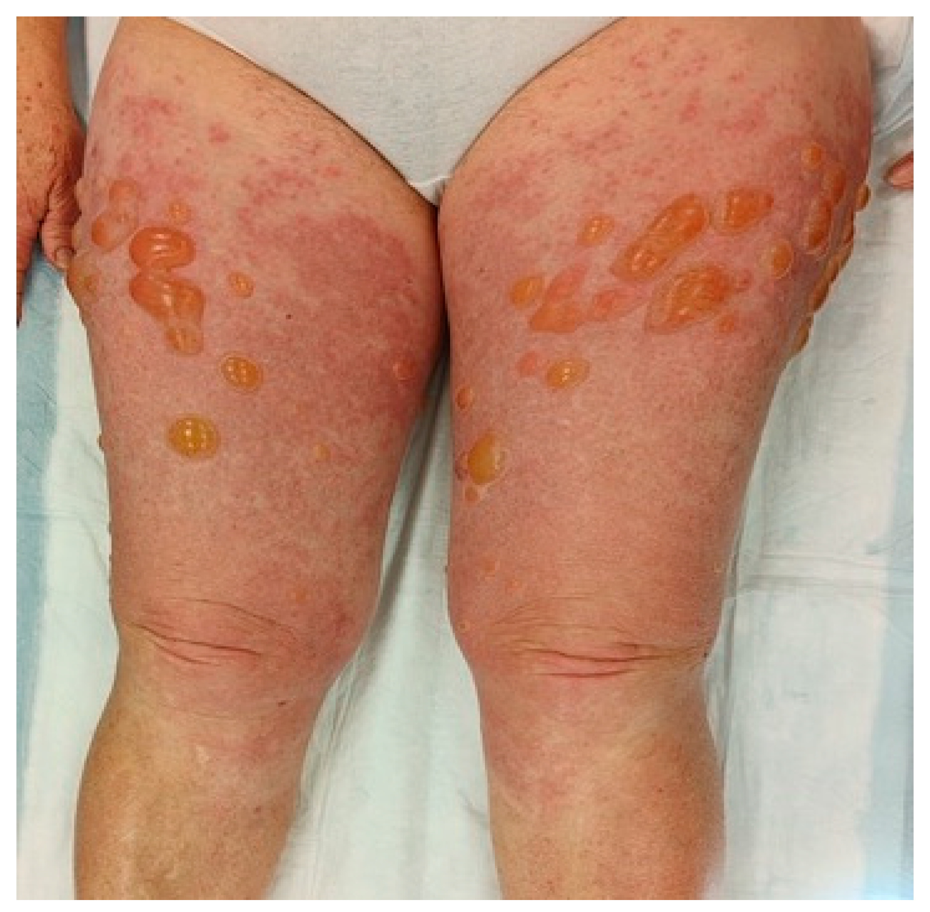 Biomedicines 11 01096 g002 Biomedicines 11 01096 g002