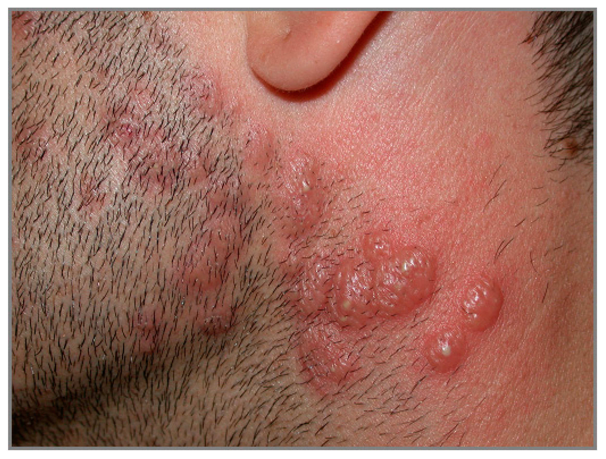 Biomedicines 11 01096 g007 Biomedicines 11 01096 g007