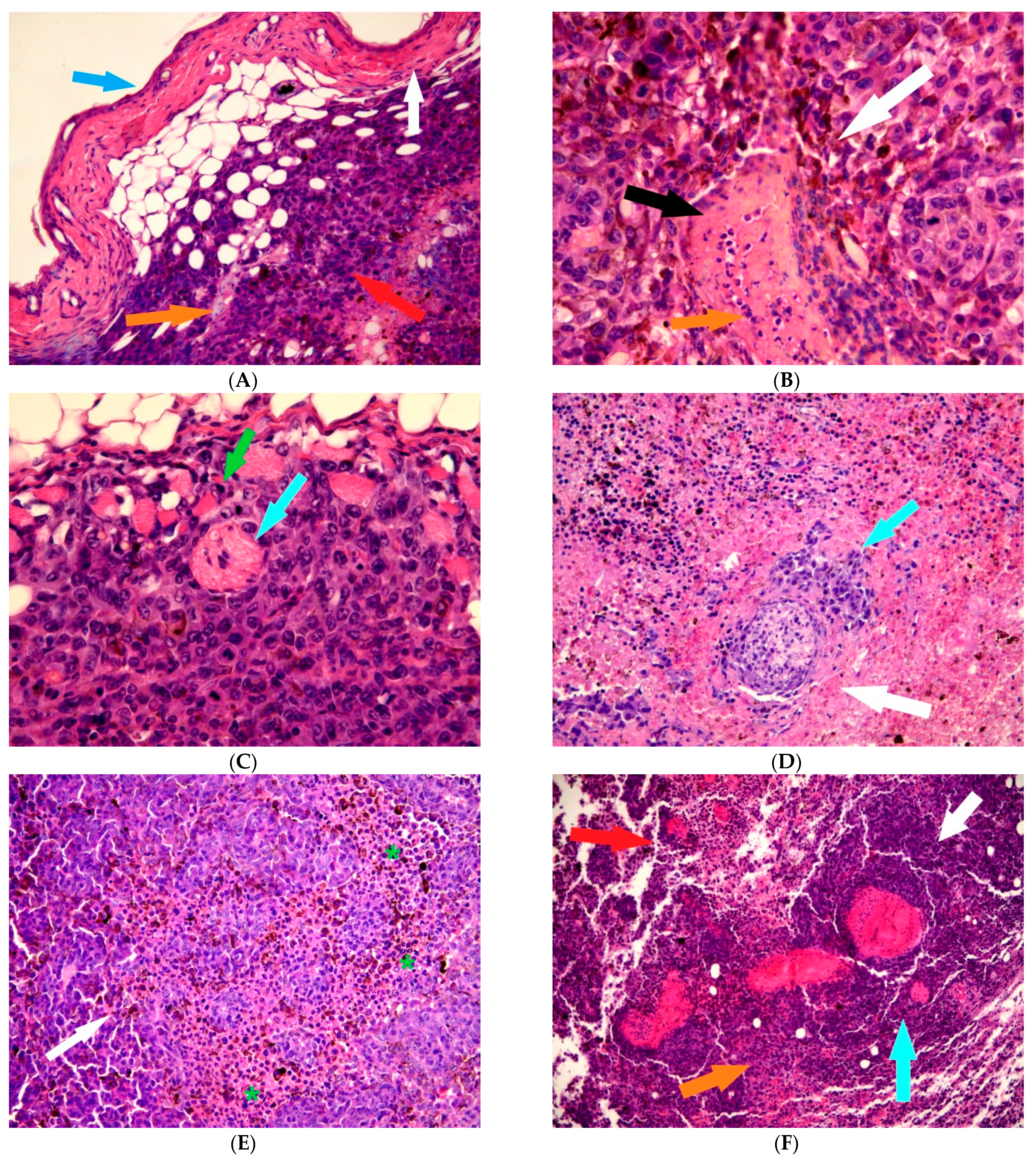 Biomedicines 11 01135 g002a Biomedicines 11 01135 g002a