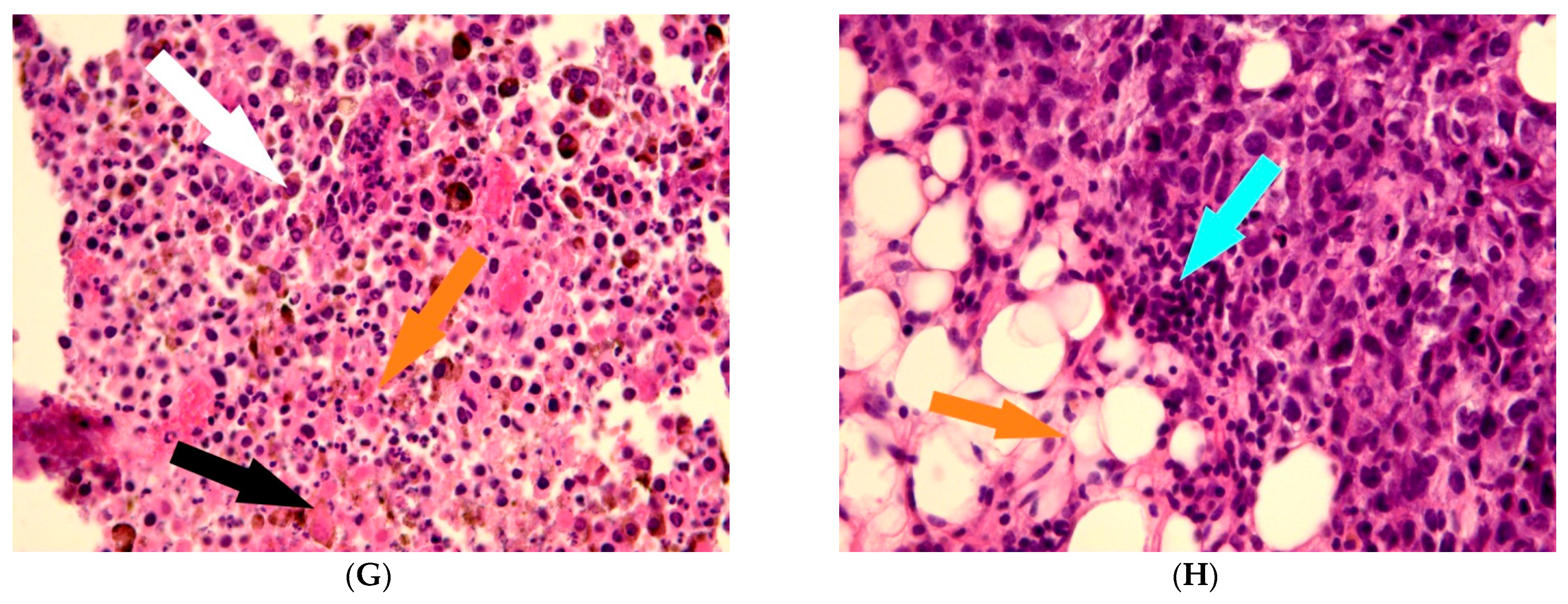 Biomedicines 11 01135 g002b Biomedicines 11 01135 g002b