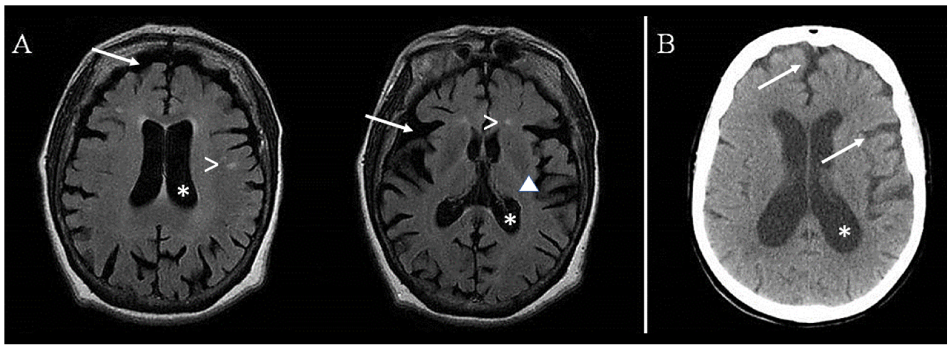 Biomedicines 11 01172 g003 Biomedicines 11 01172 g003