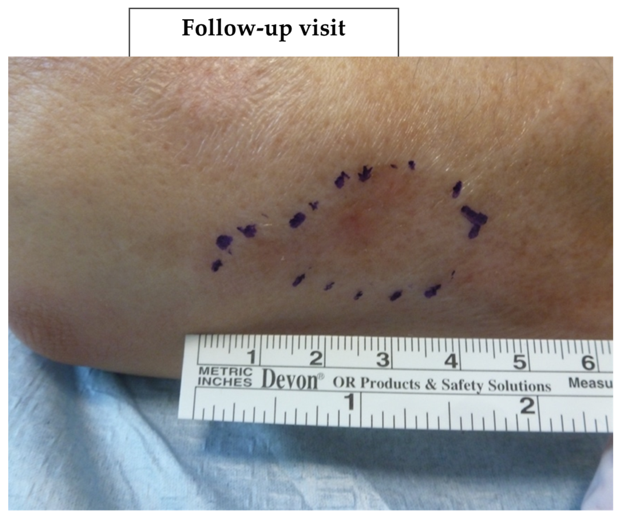 Biomedicines 11 01190 g006b