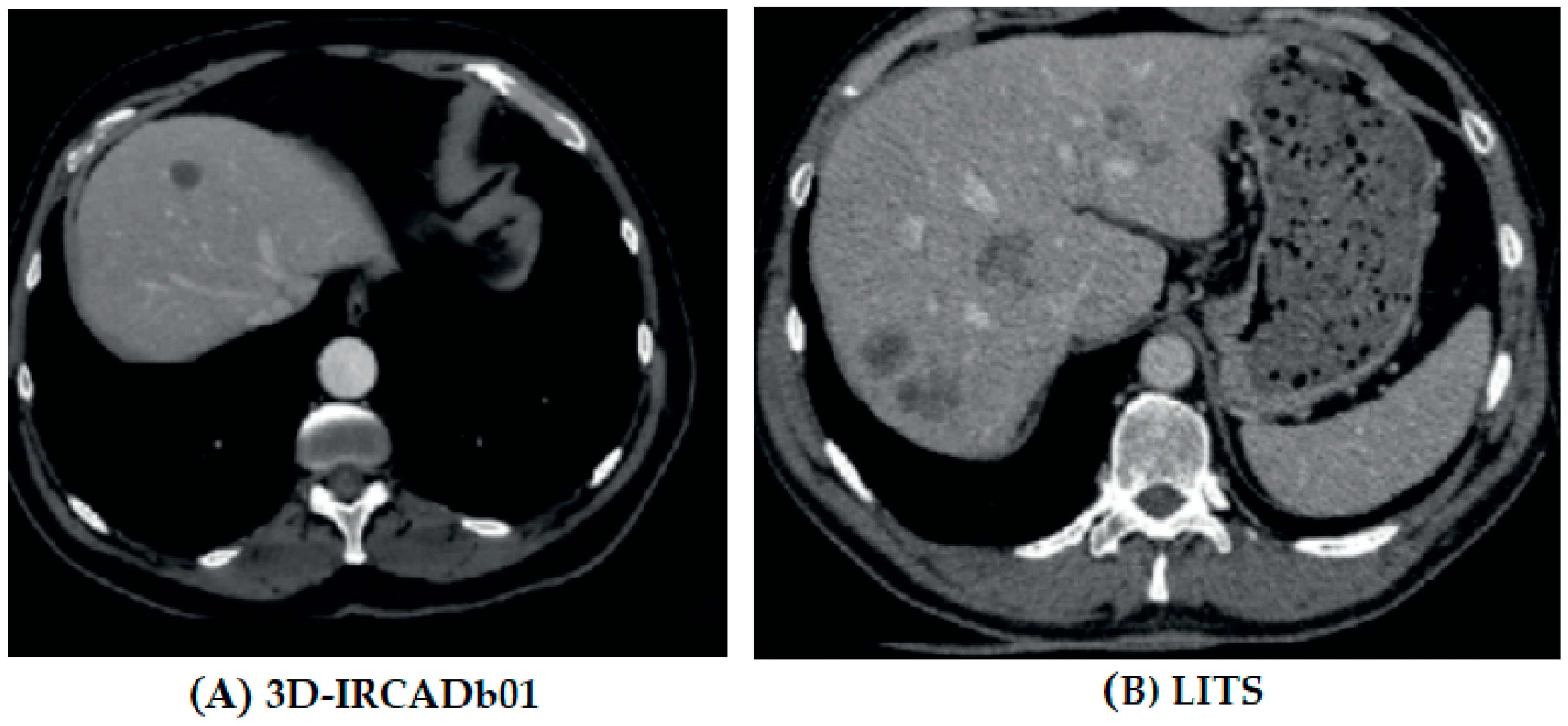Biomedicines 11 01309 g001