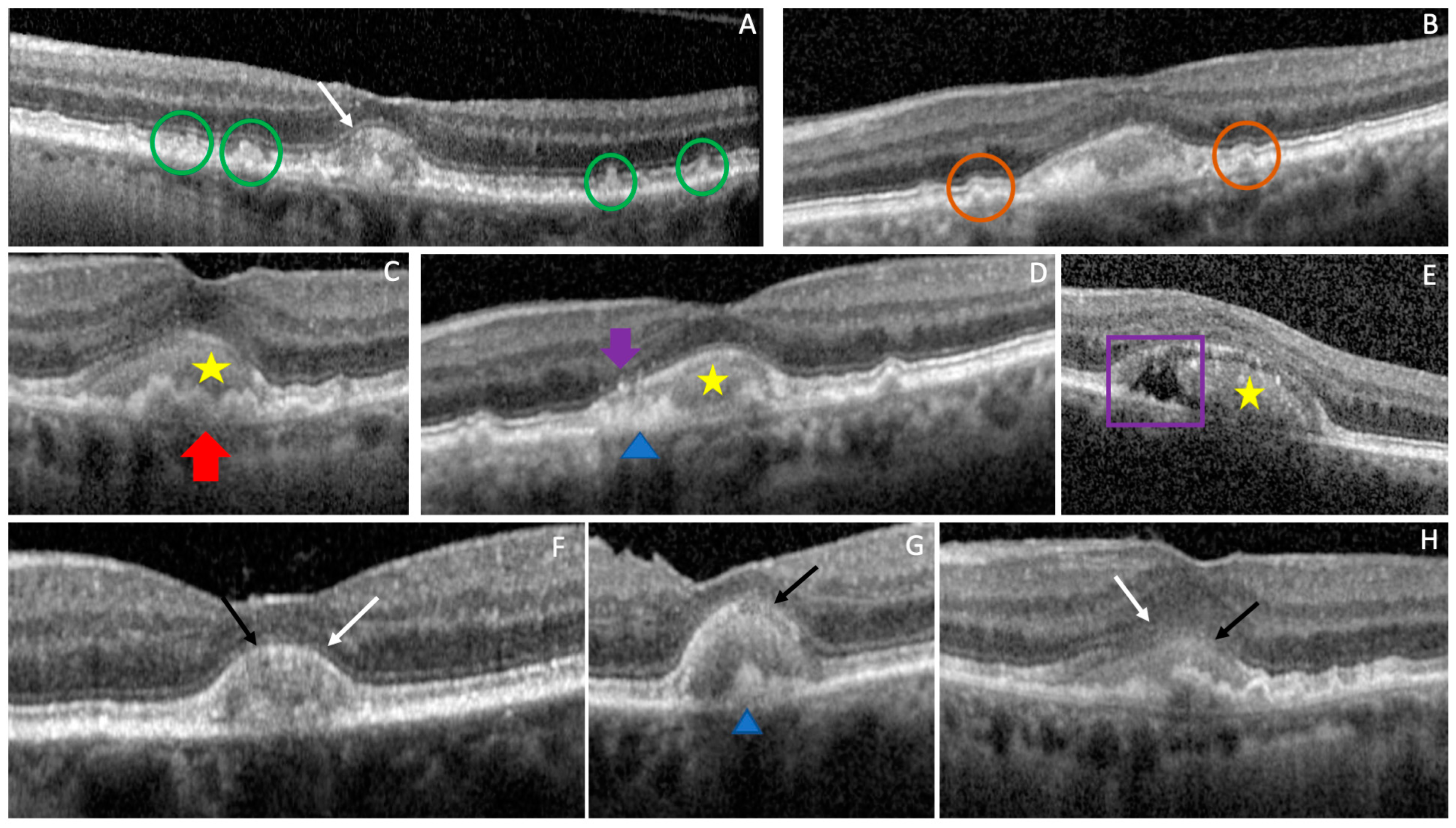 Biomedicines 11 01382 g004