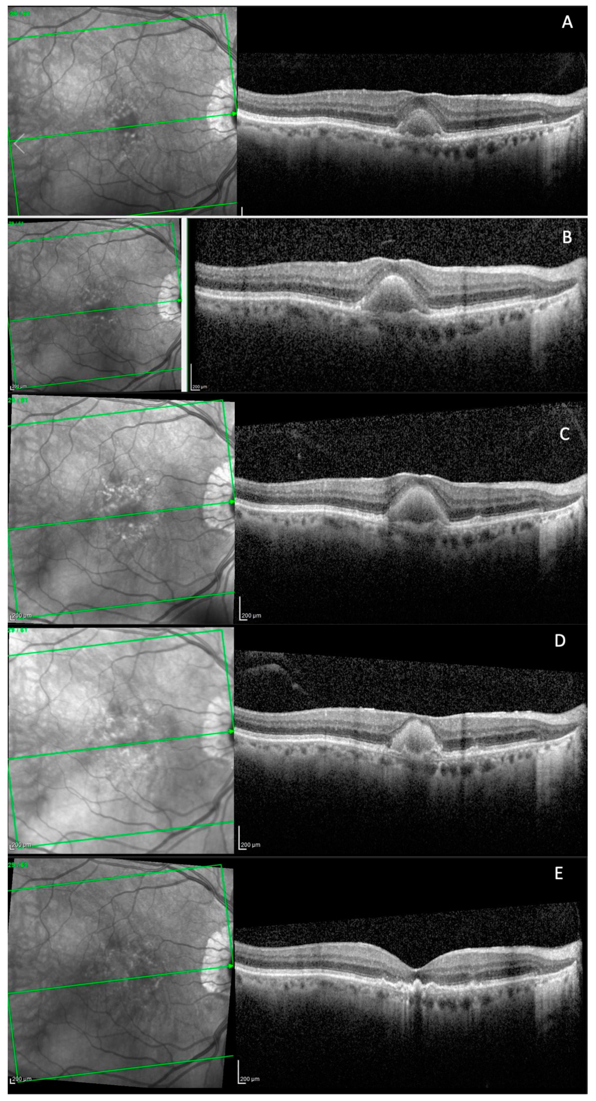 Biomedicines 11 01382 g005