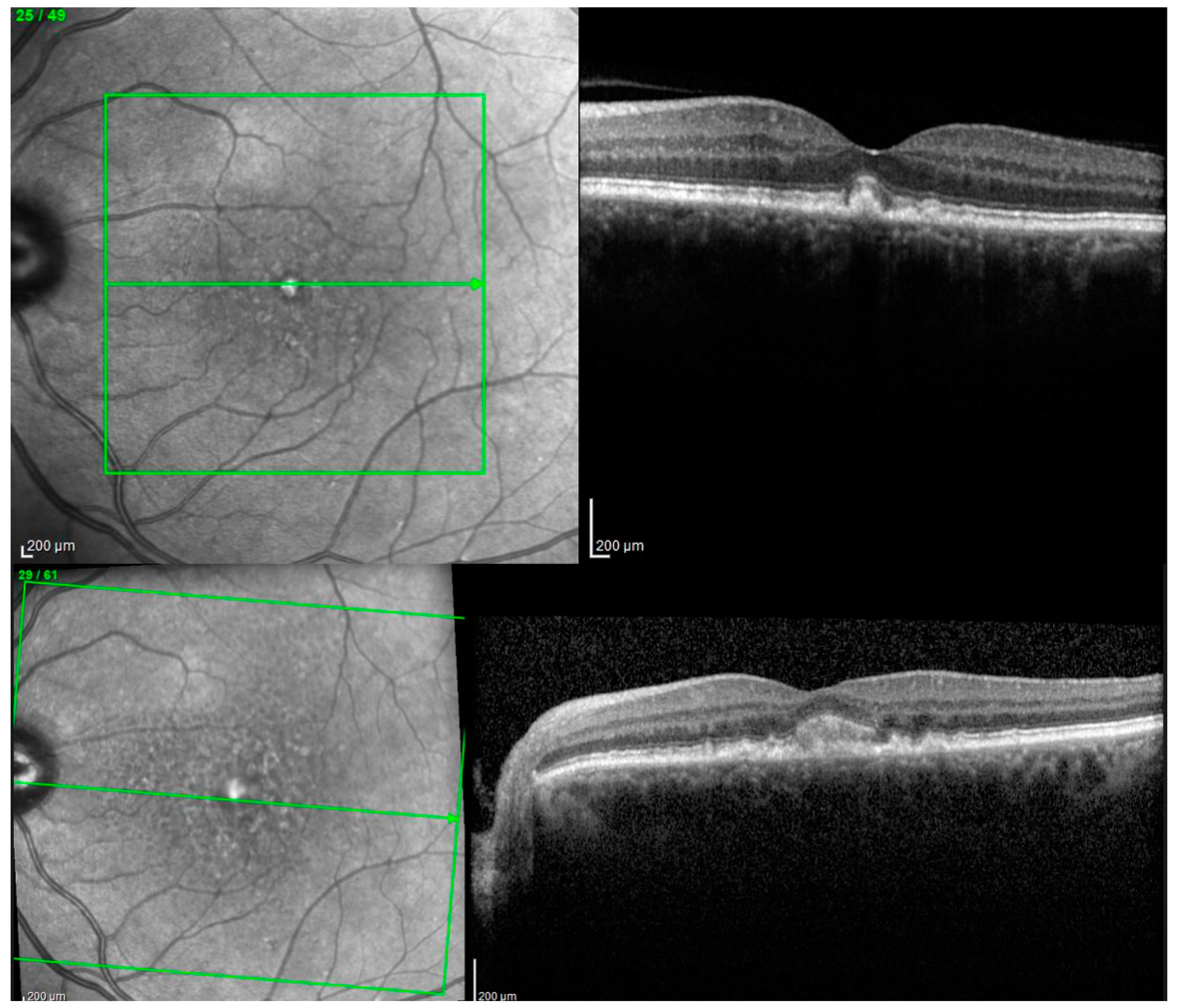 Biomedicines 11 01382 g006