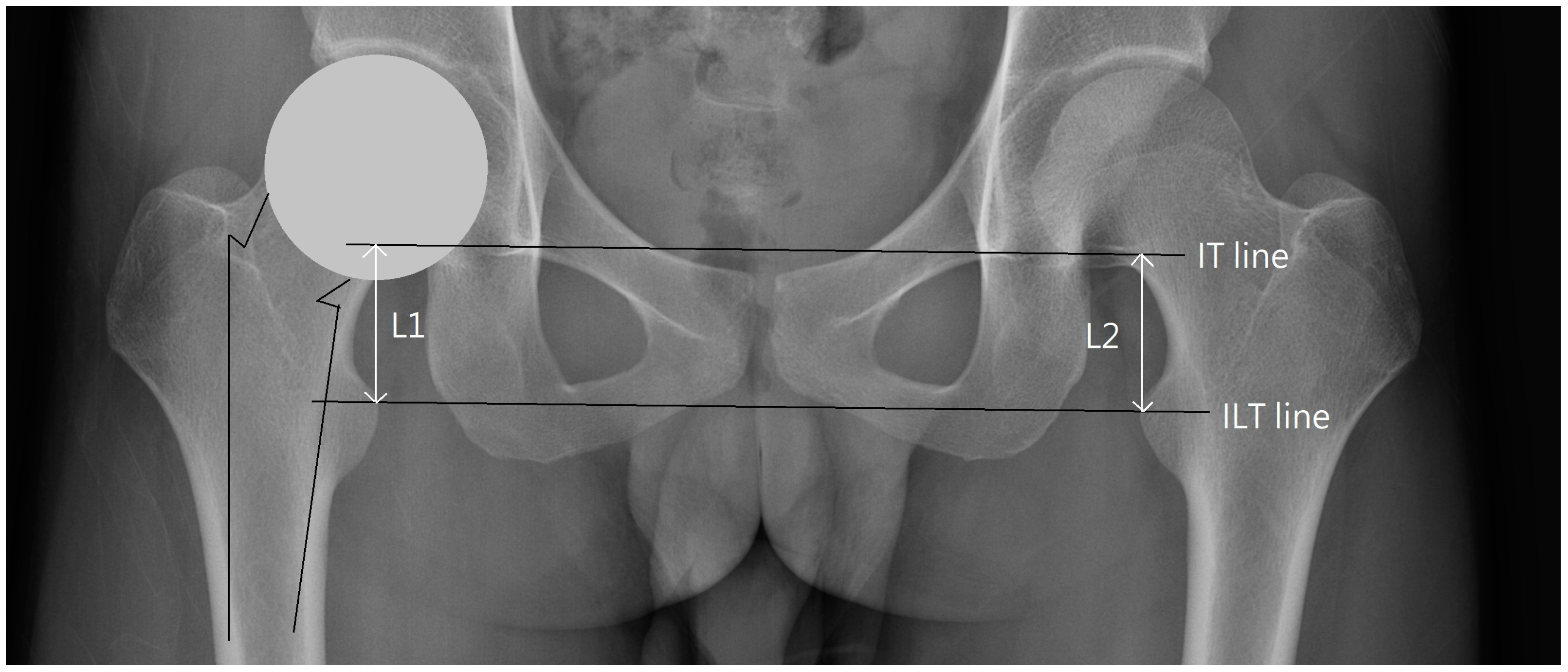 Biomedicines Free FullText The Transverse Mechanical Axis of the