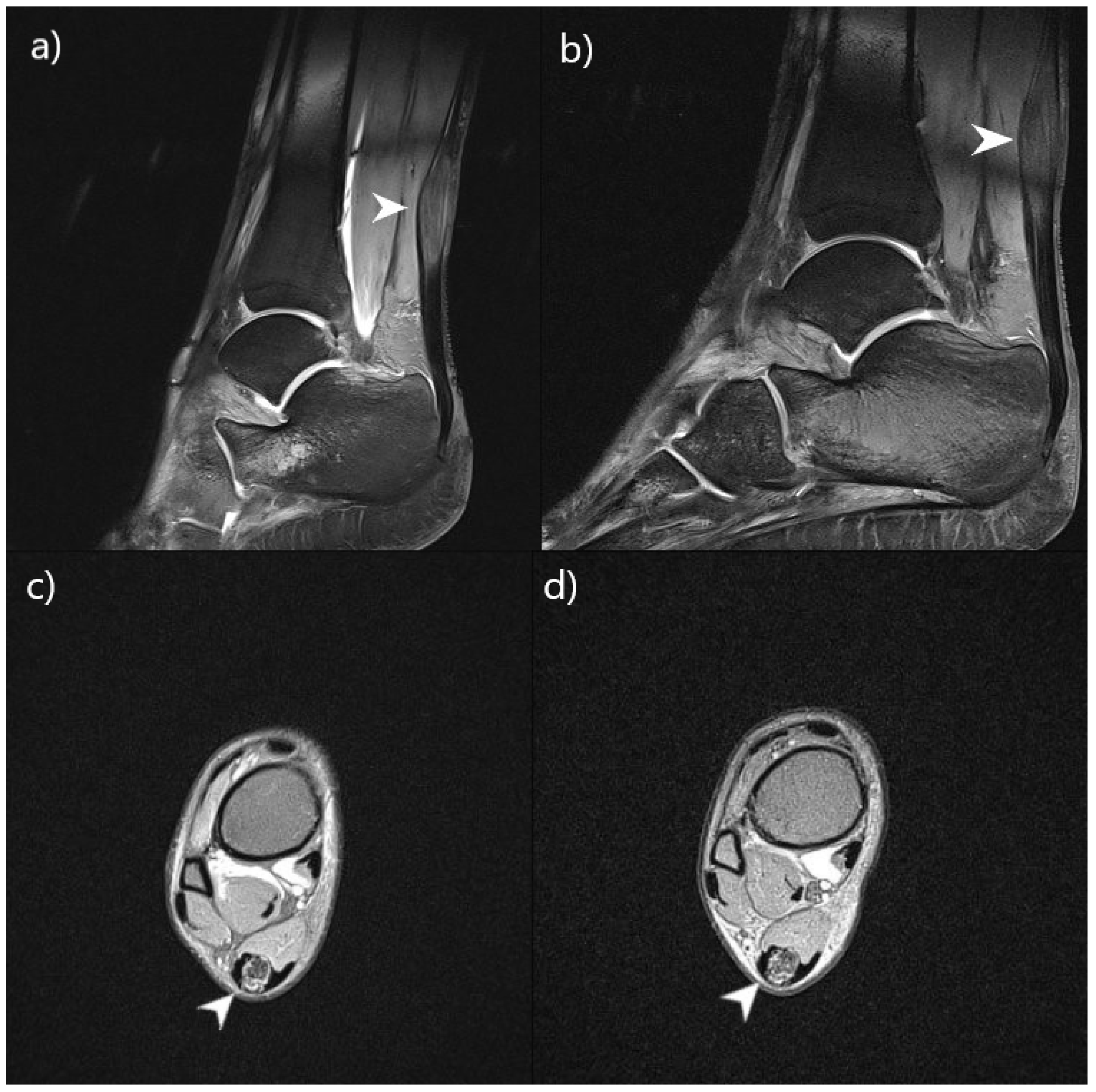 Biomedicines 11 01430 g003 Biomedicines 11 01430 g003