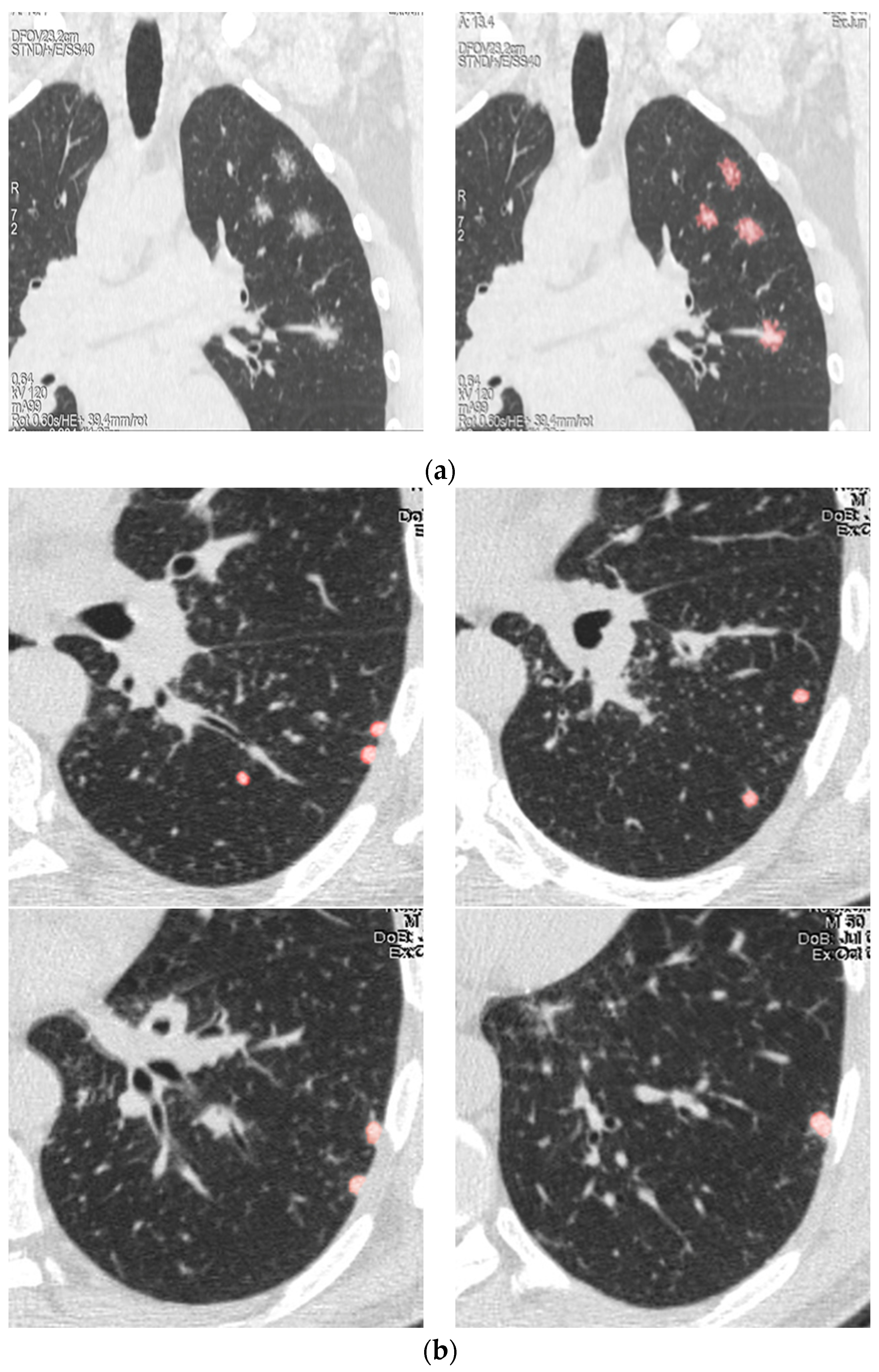 Biomedicines 11 01437 g001a