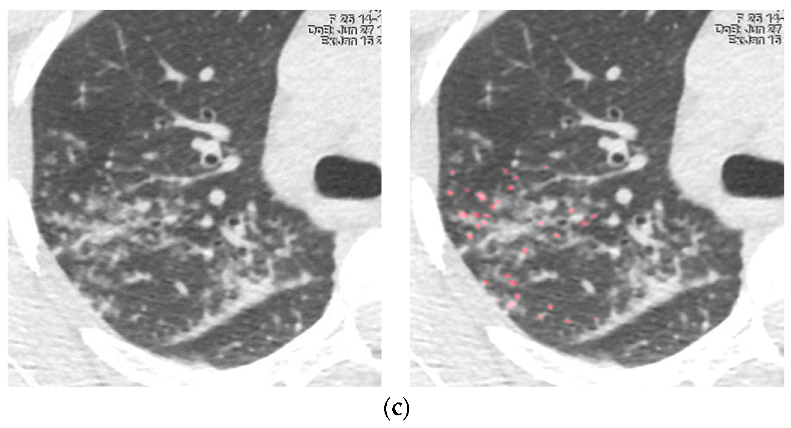 Biomedicines 11 01437 g001b