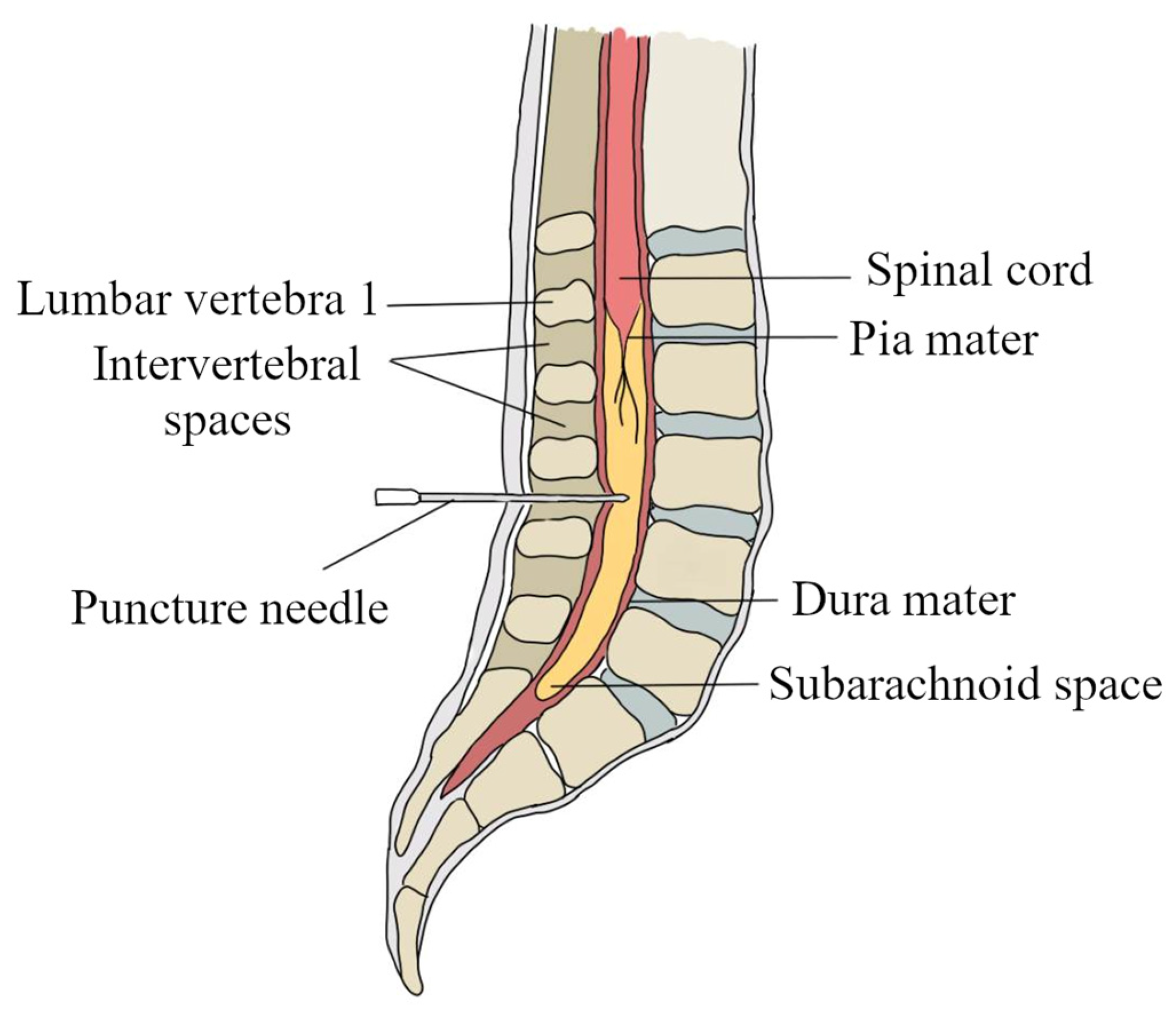 Biomedicines Free FullText Cerebrospinal FluidBasic Concepts Review