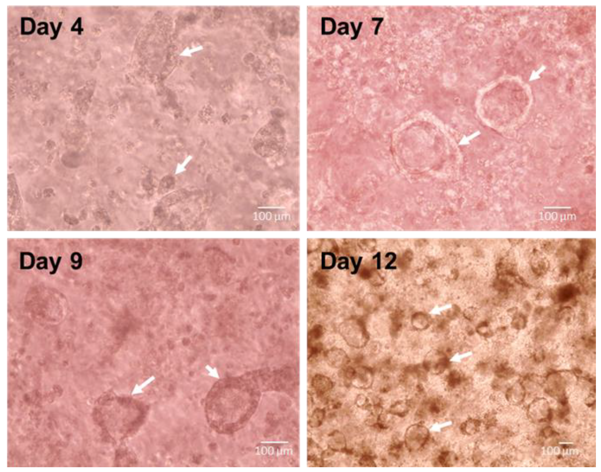 Biomedicines 11 01476 g0a1 Biomedicines 11 01476 g0a1