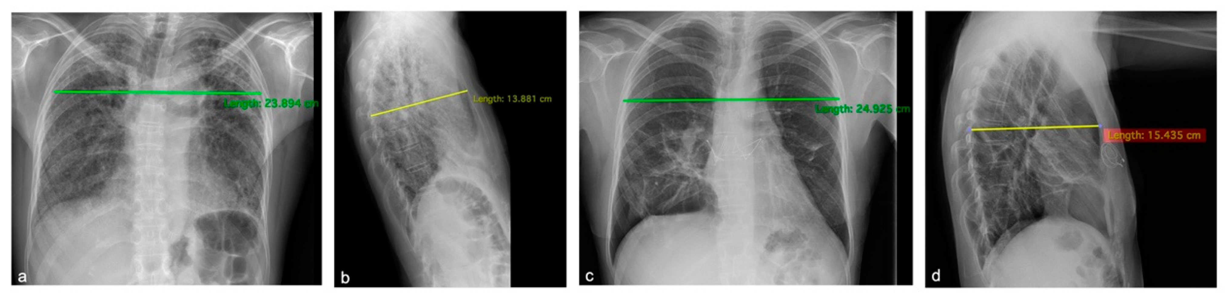 Biomedicines 11 01505 g001 Biomedicines 11 01505 g001