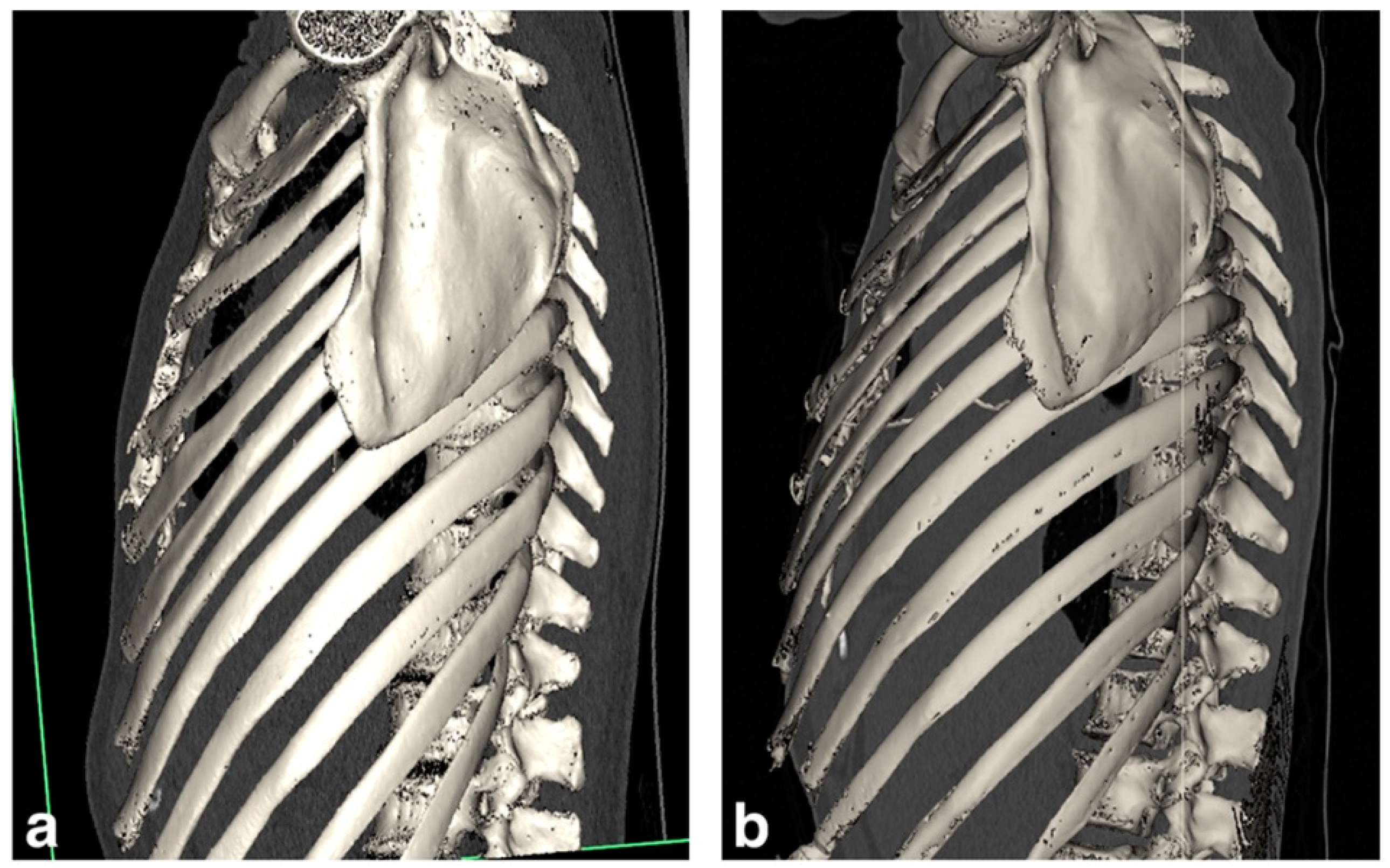 Biomedicines 11 01505 g002 Biomedicines 11 01505 g002
