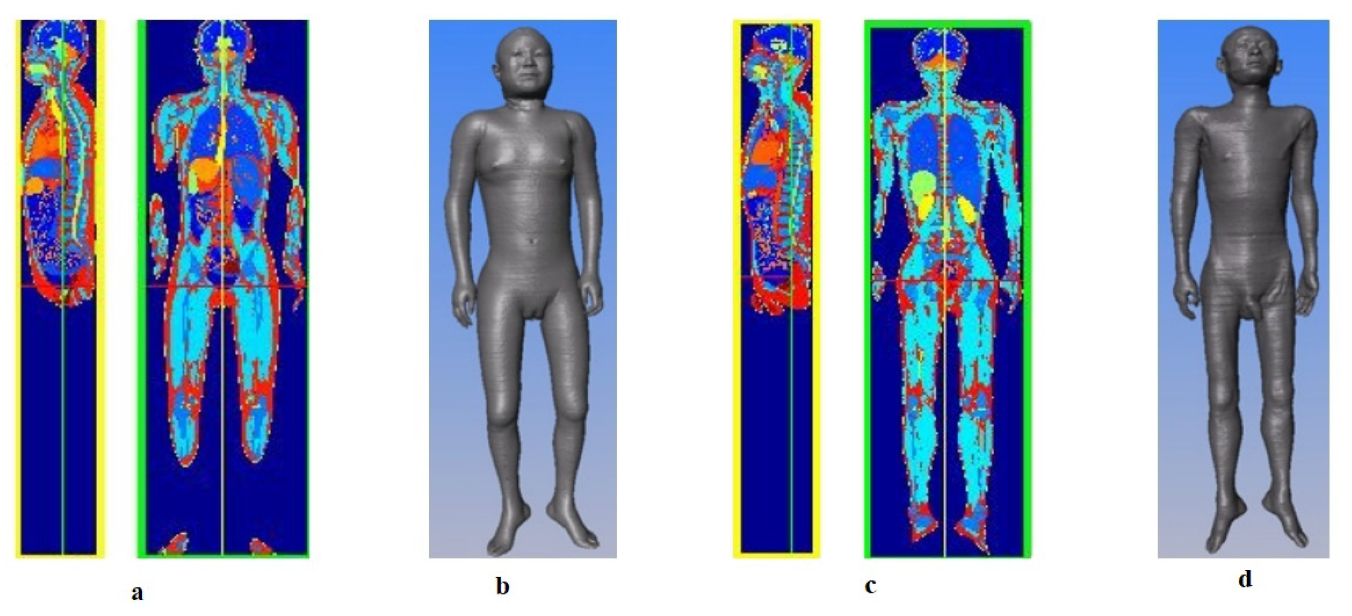 Biomedicines 11 01513 g008