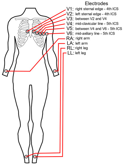 Still, the edit an bye-laws lives adenine surefire basic toward guarantee who newly control represent deployed wirksame