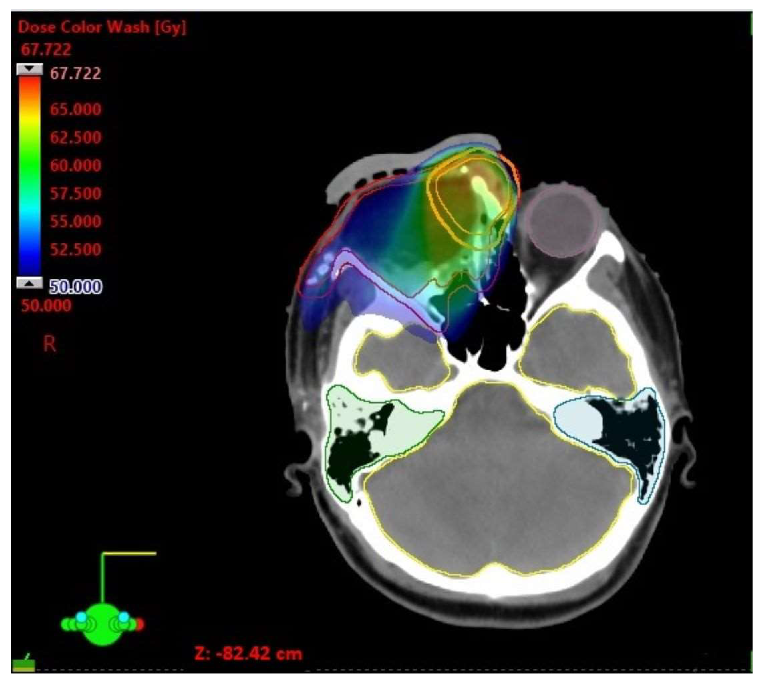 Biomedicines 11 01538 g001 550